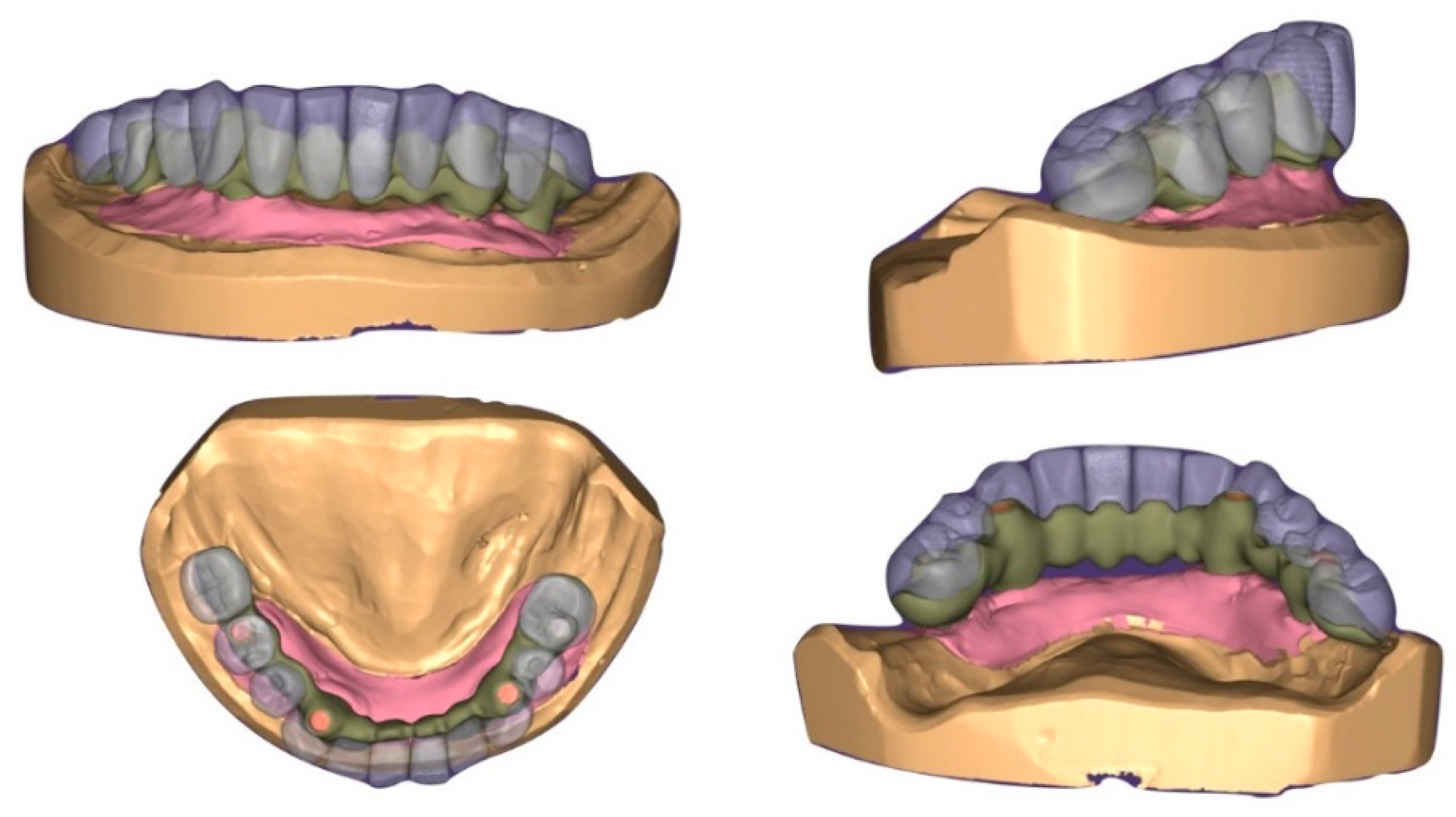 Prosthesis 02 00033 g003