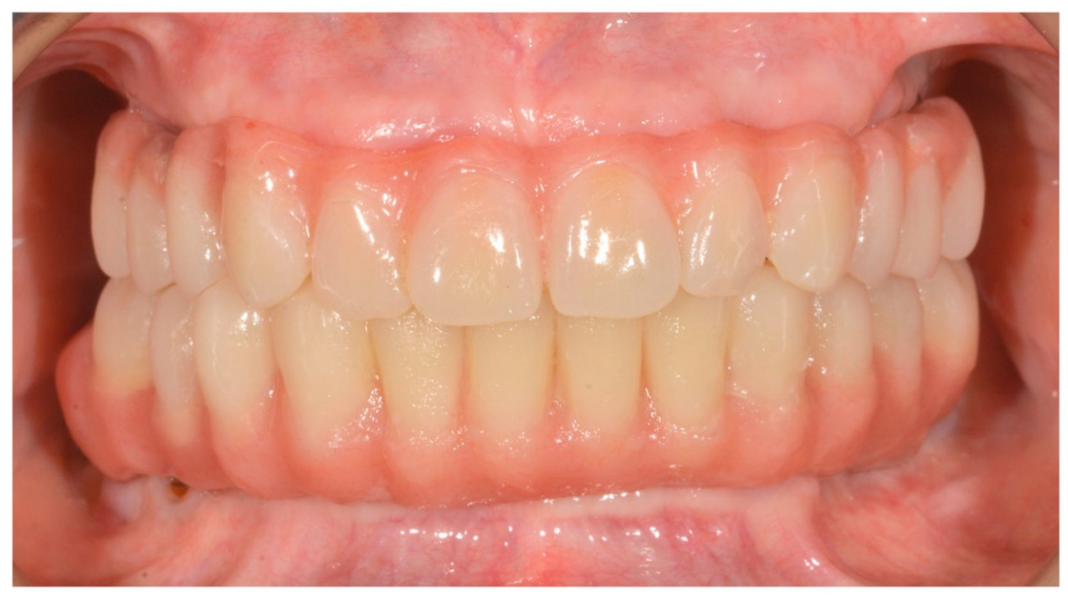 Prosthesis 02 00033 g005