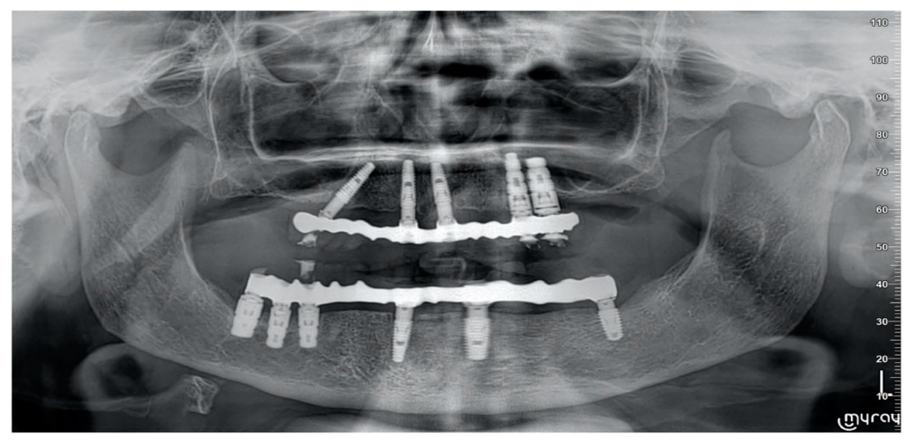 Prosthesis 02 00033 g006