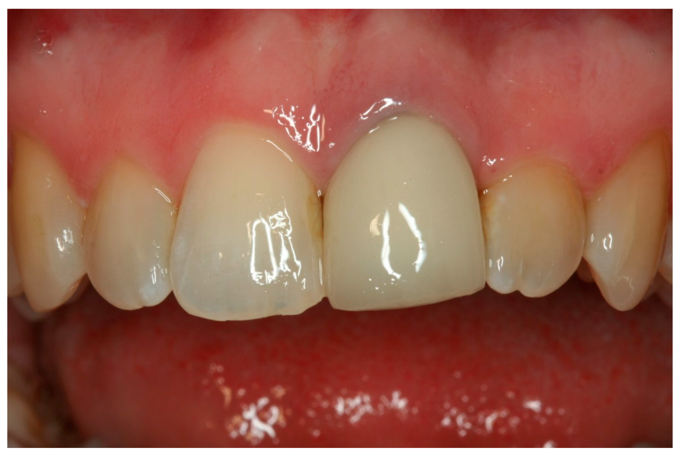 Prosthesis 03 00014 g001 Prosthesis 03 00014 g001