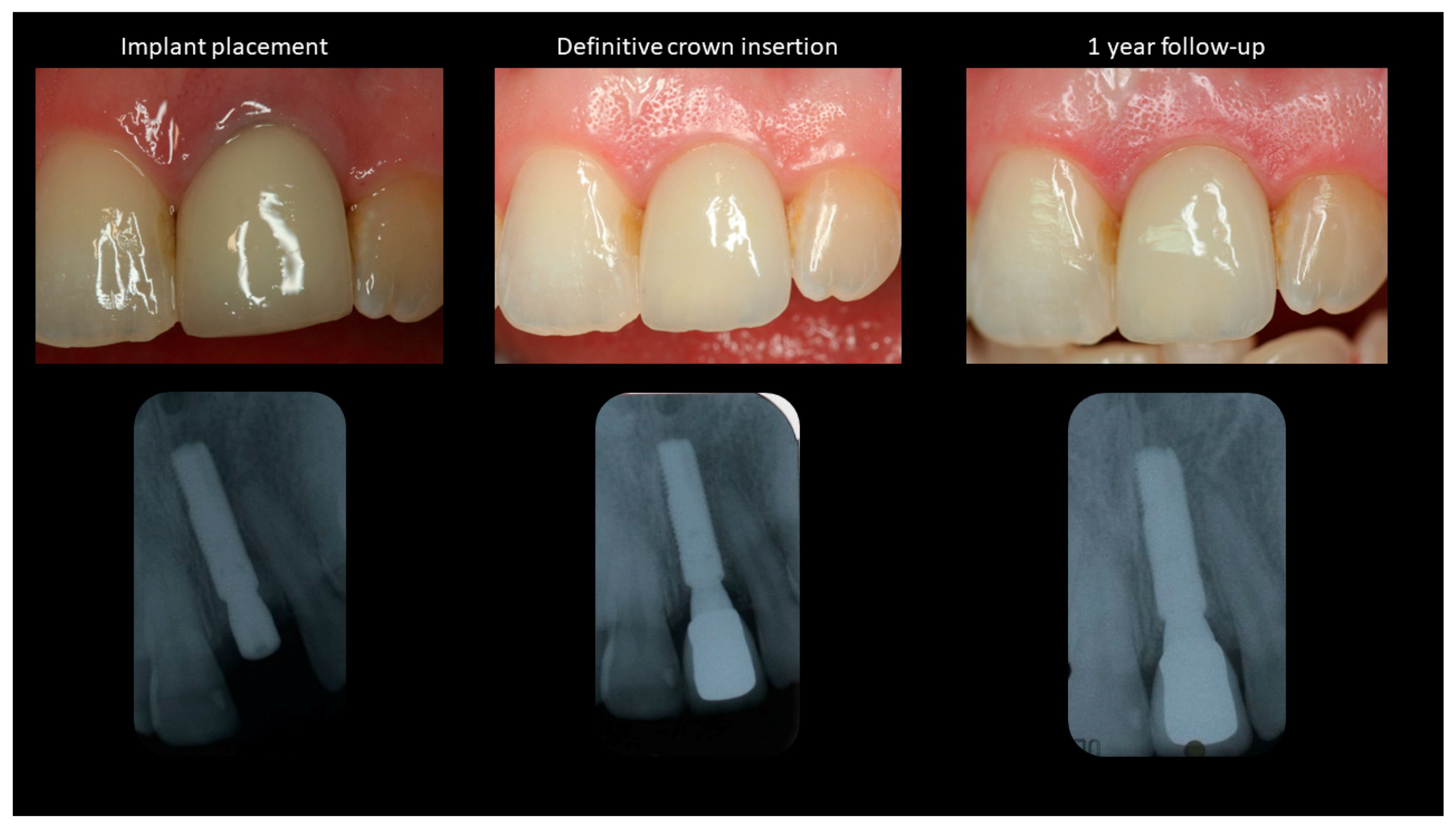 Prosthesis 03 00014 g002 Prosthesis 03 00014 g002