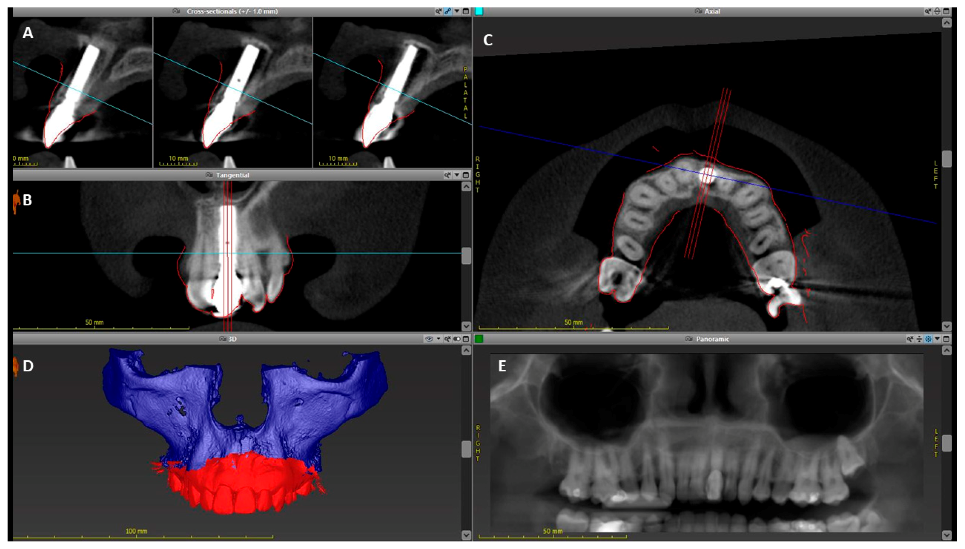 Prosthesis 03 00014 g004 Prosthesis 03 00014 g004