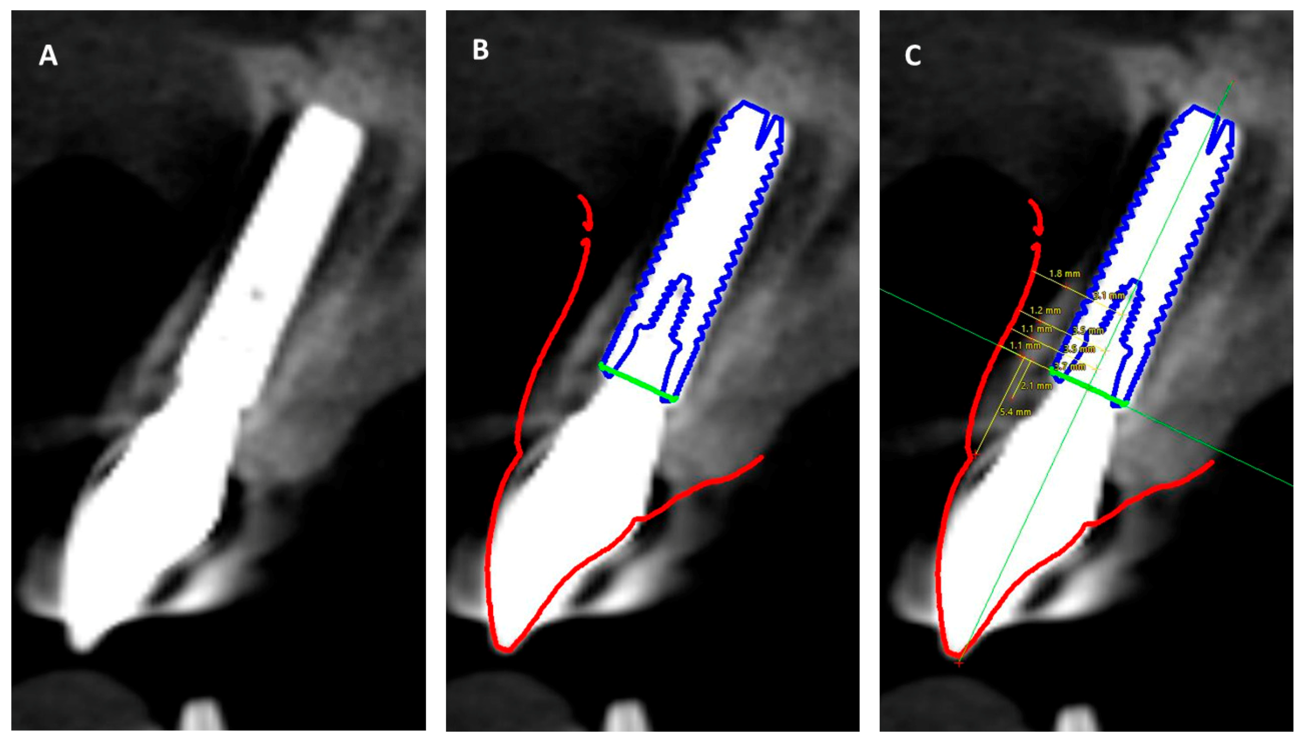 Prosthesis 03 00014 g005 Prosthesis 03 00014 g005