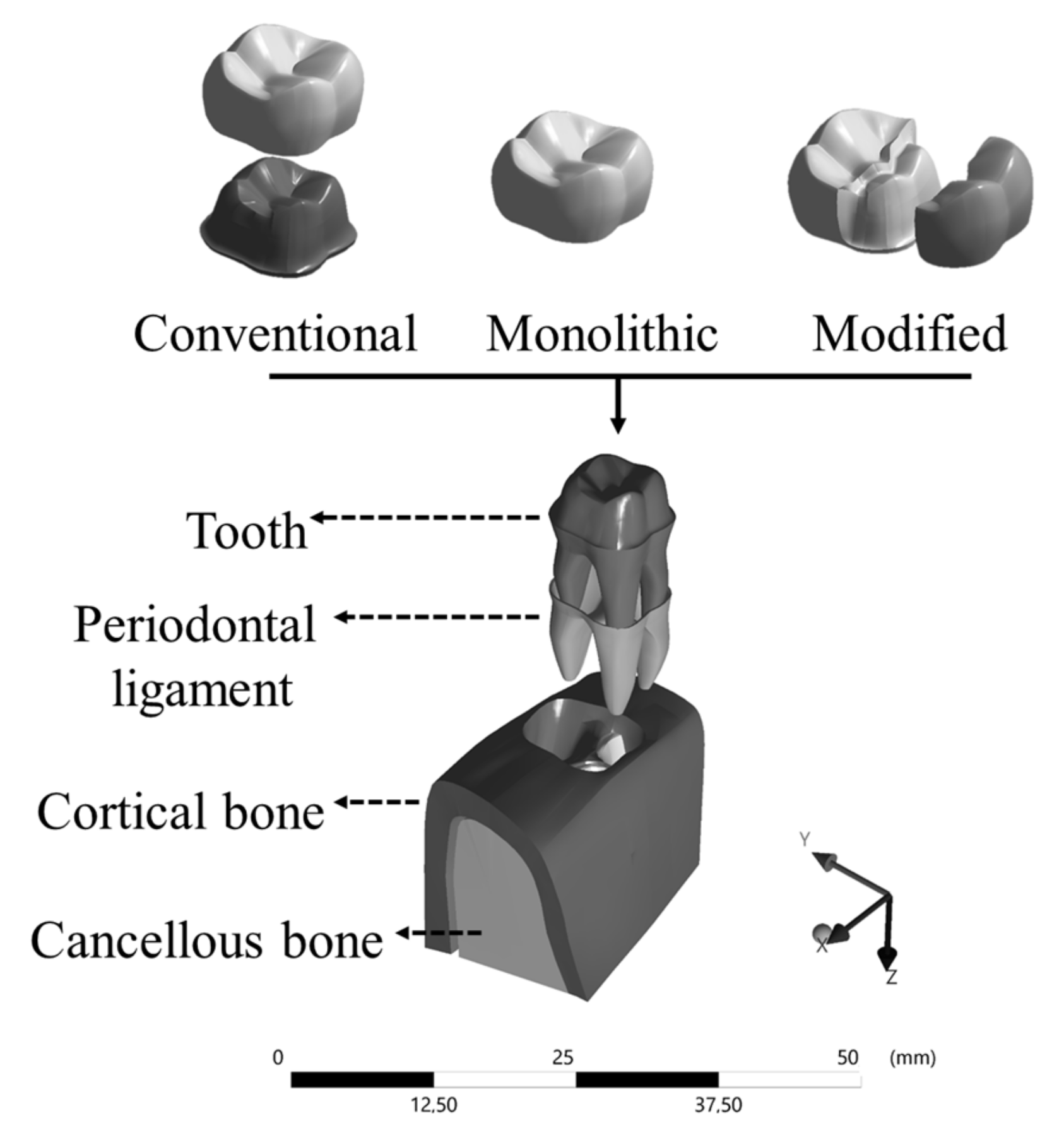 Prosthesis 03 00017 g001