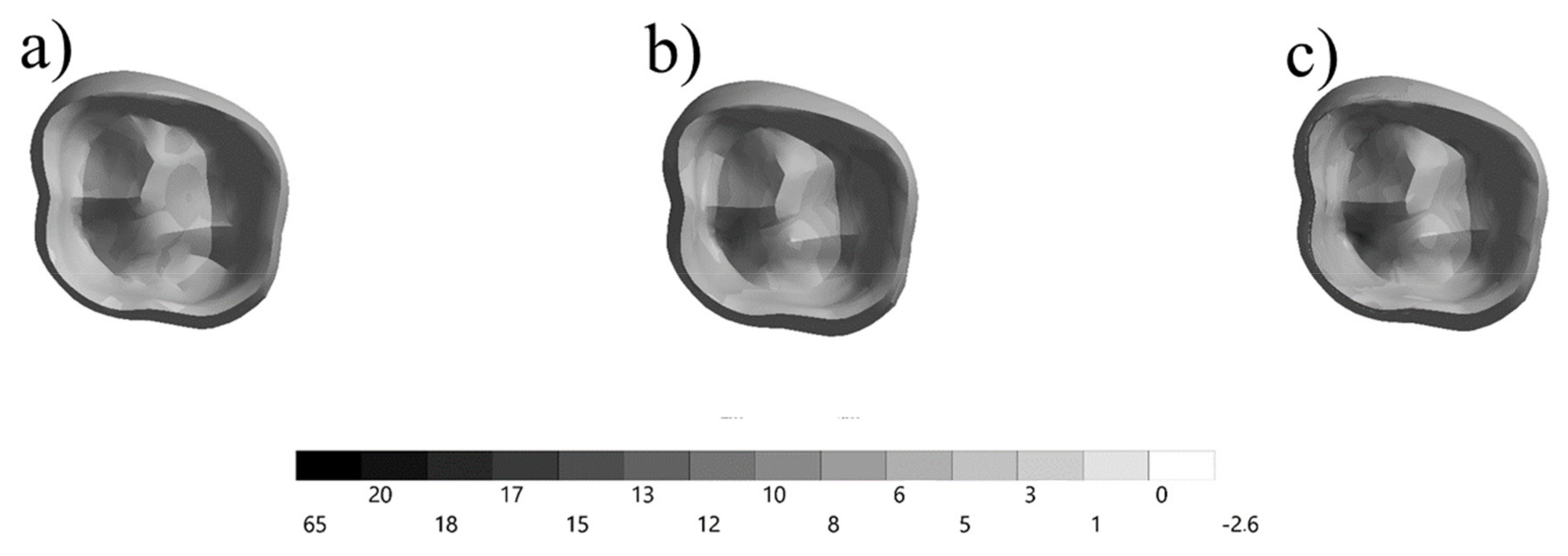 Prosthesis 03 00017 g004