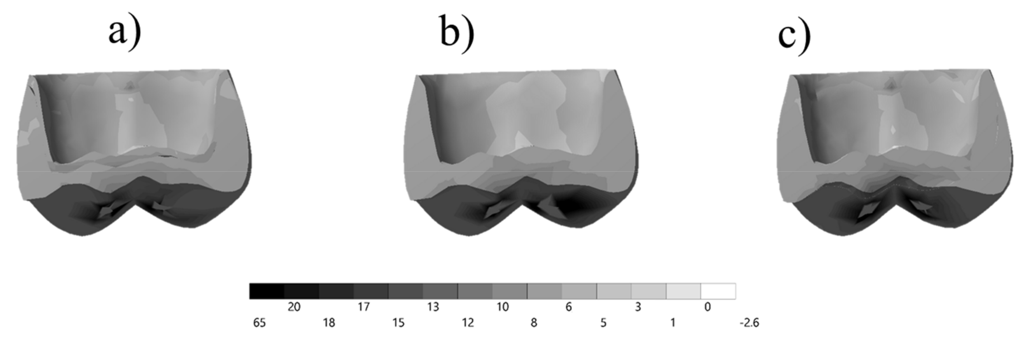 Prosthesis 03 00017 g005