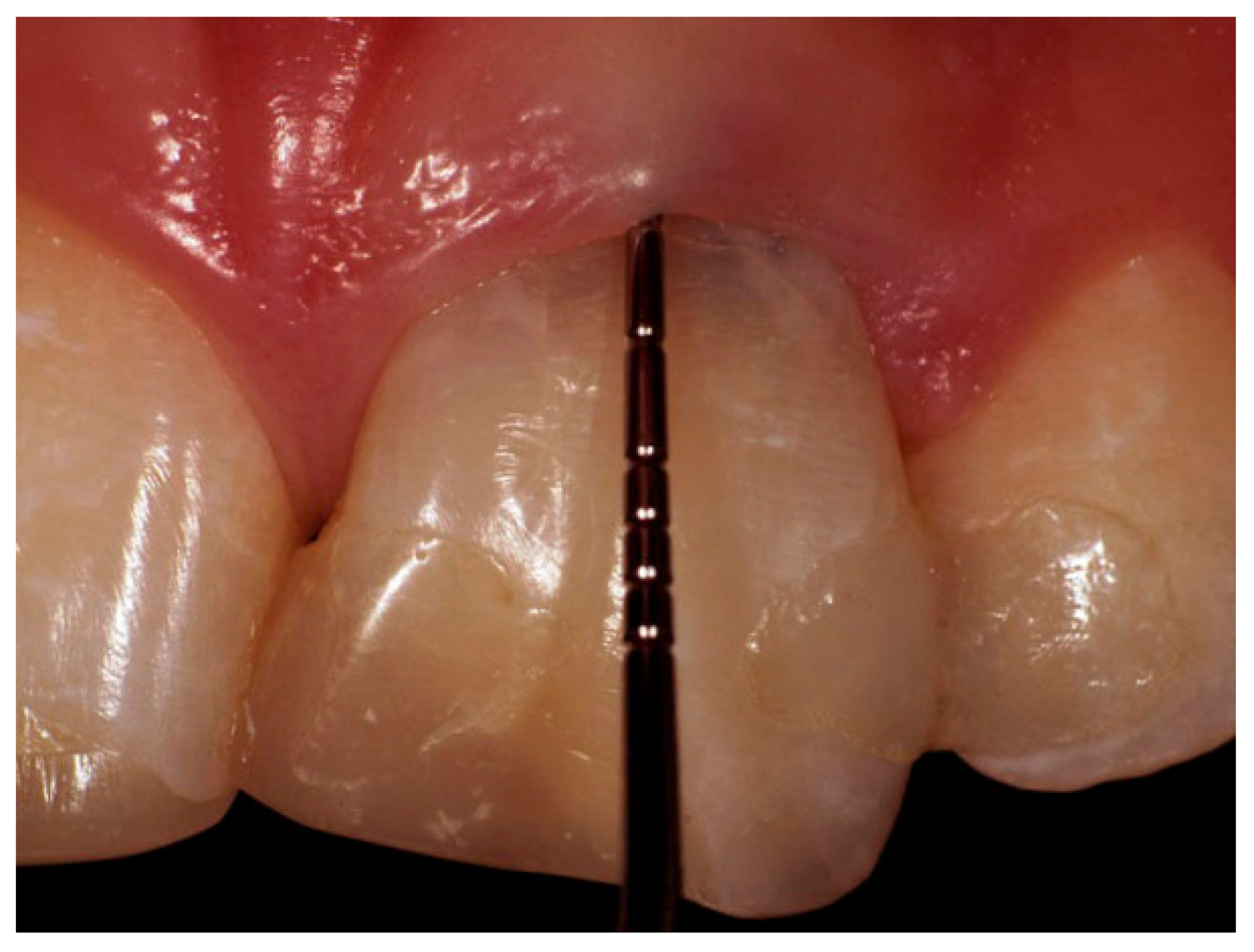 Prosthesis 03 00021 g001