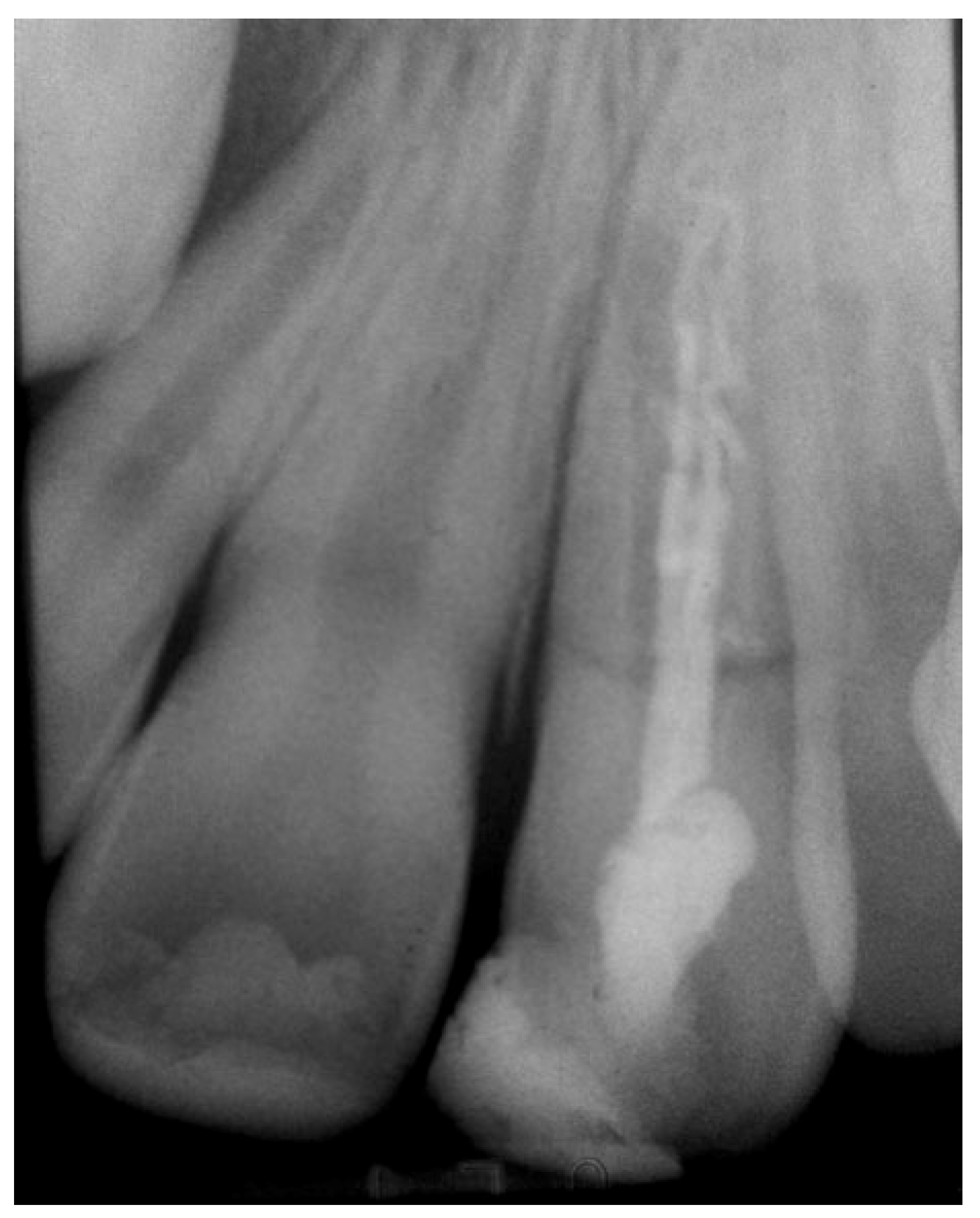 Prosthesis 03 00021 g002
