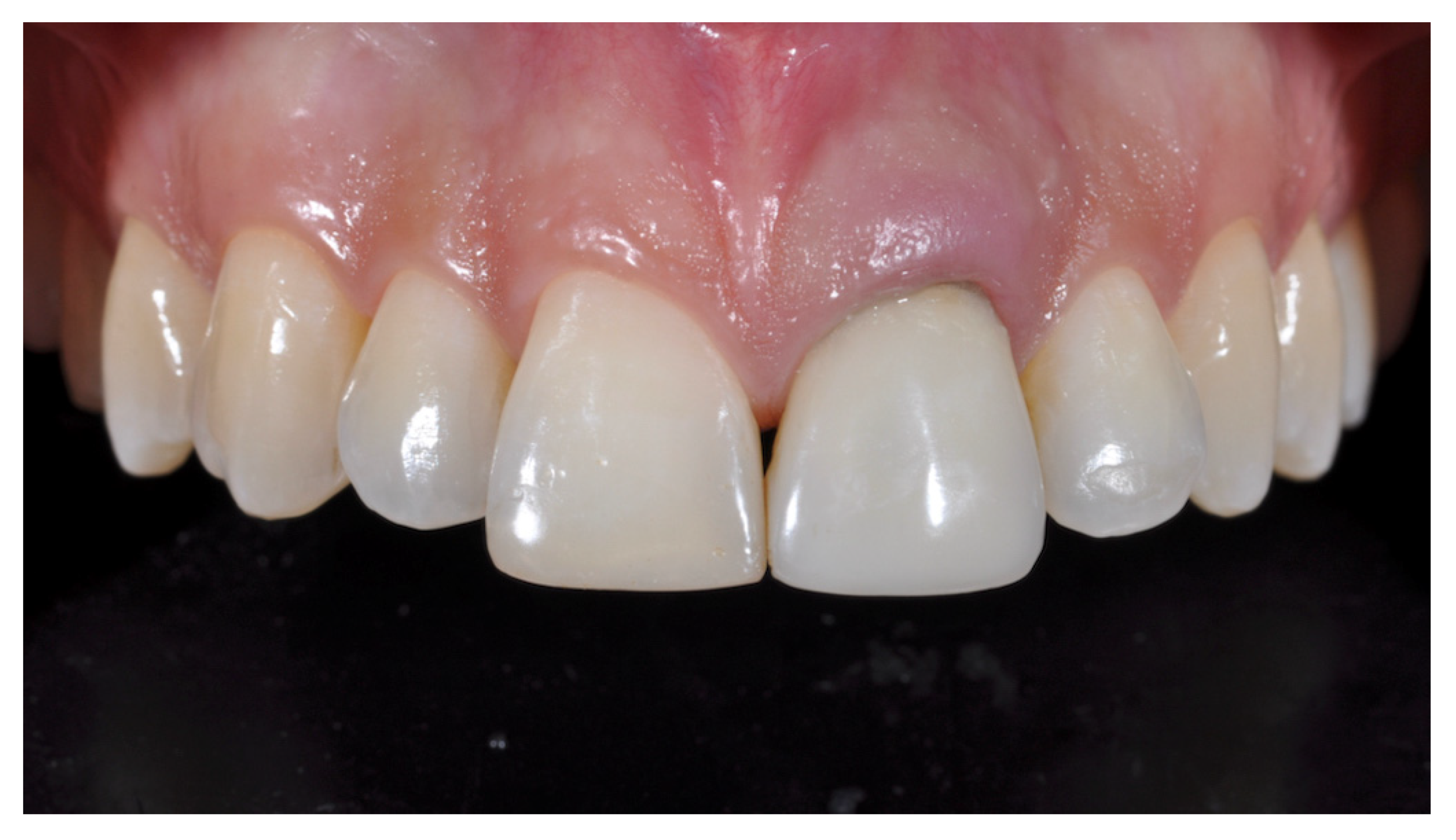 Prosthesis 03 00021 g003
