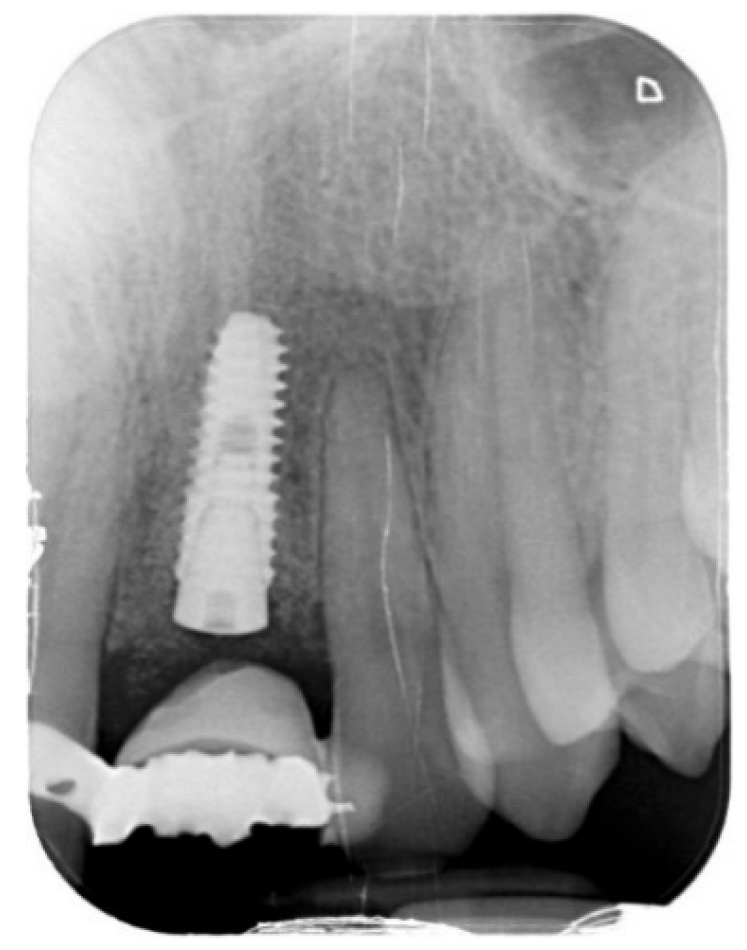 Prosthesis 03 00021 g009