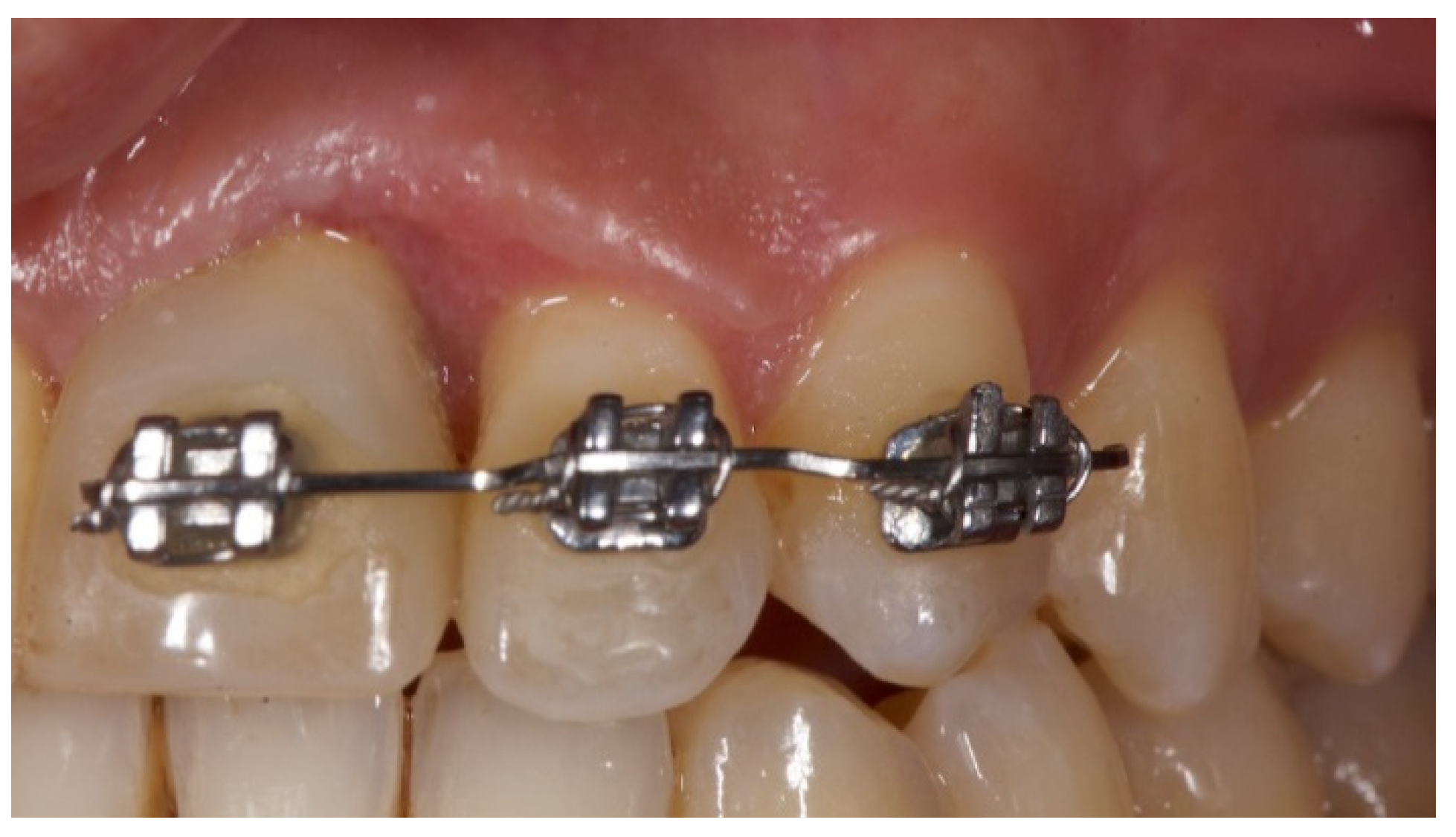 Prosthesis 03 00021 g011