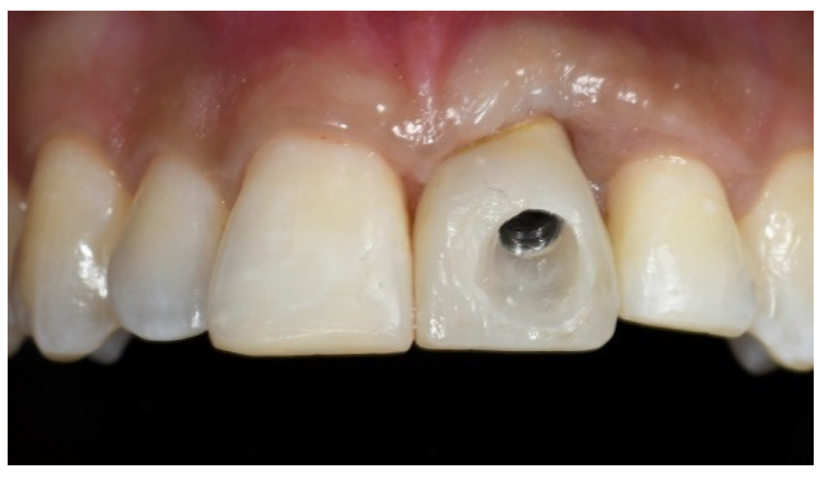 Prosthesis 03 00021 g012