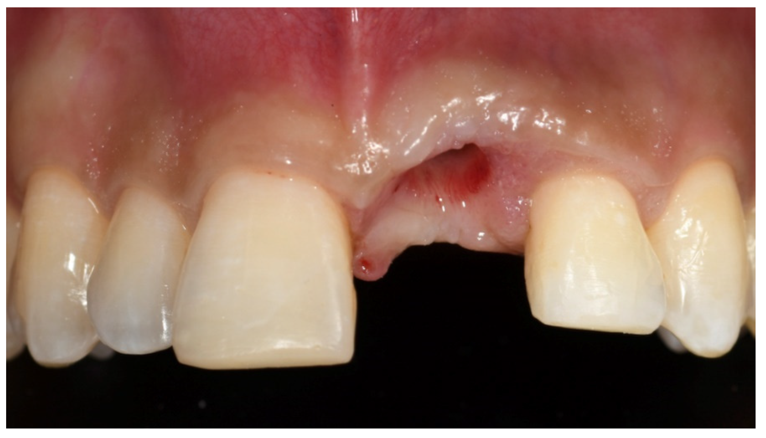 Prosthesis 03 00021 g013