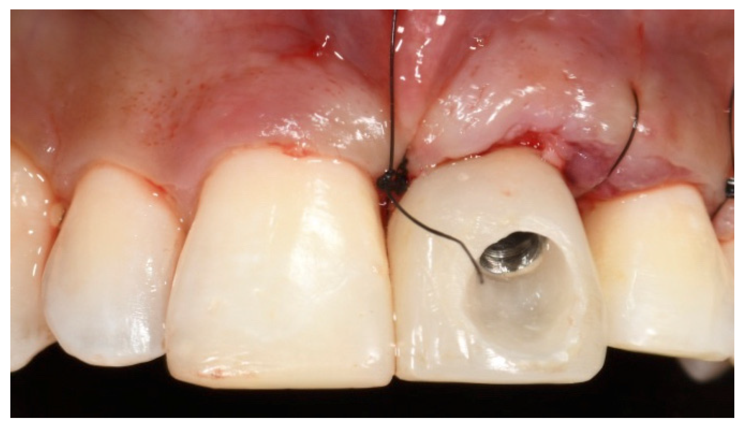 Prosthesis 03 00021 g015