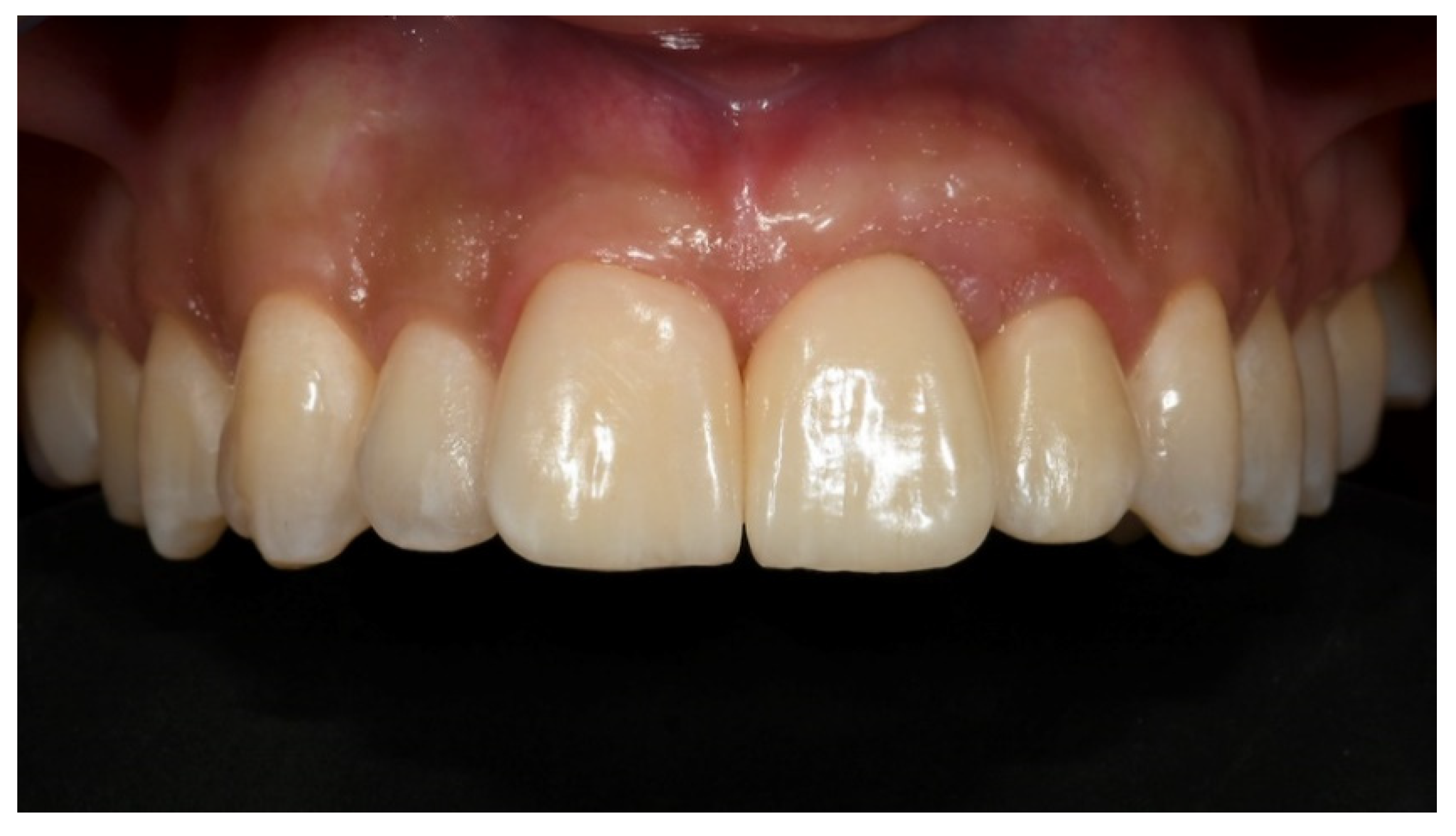 Prosthesis 03 00021 g016