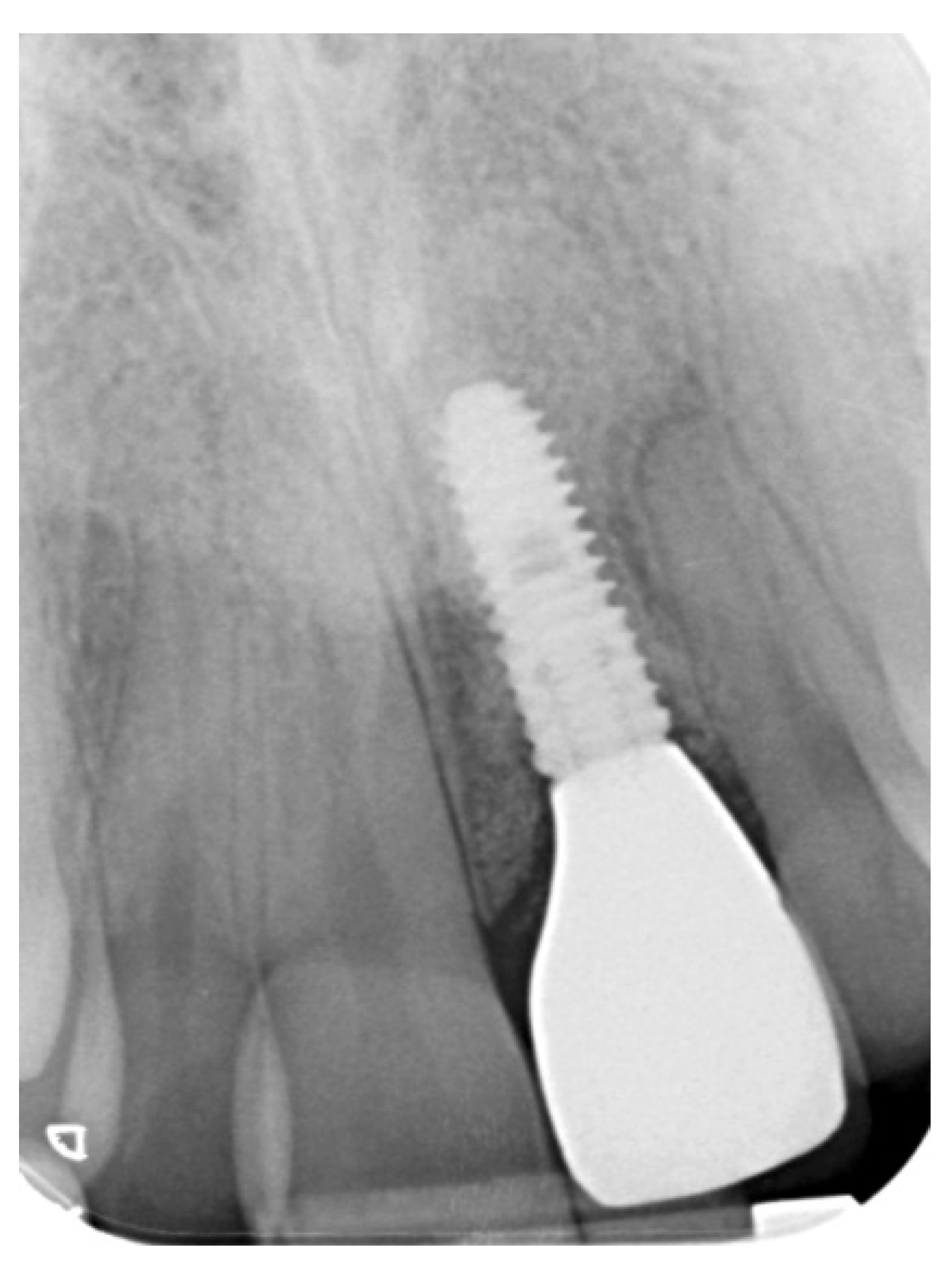 Prosthesis 03 00021 g019