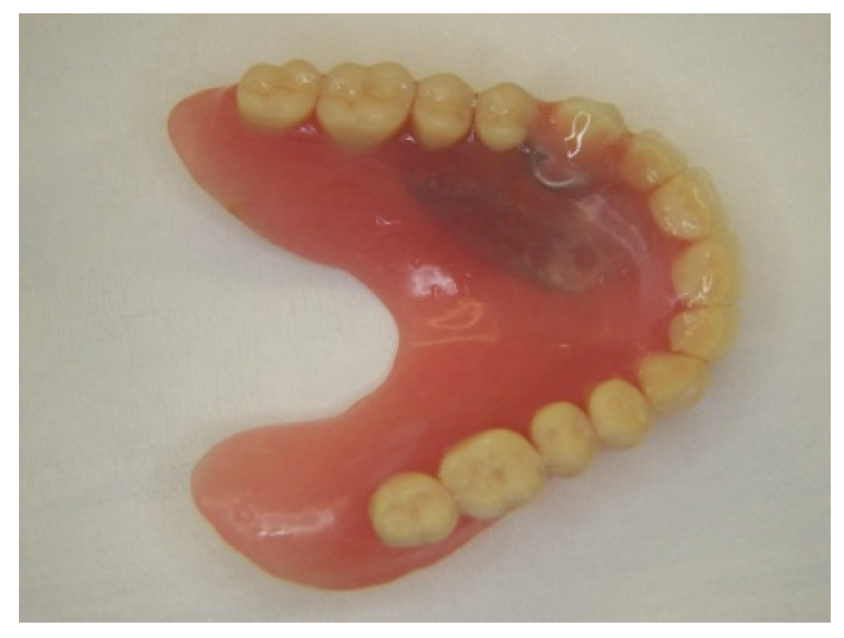 Prosthesis 03 00023 g001