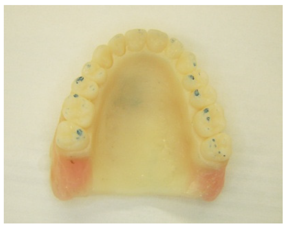 Prosthesis 03 00023 g014