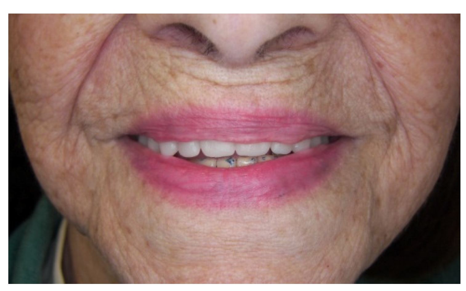 Prosthesis 03 00023 g015