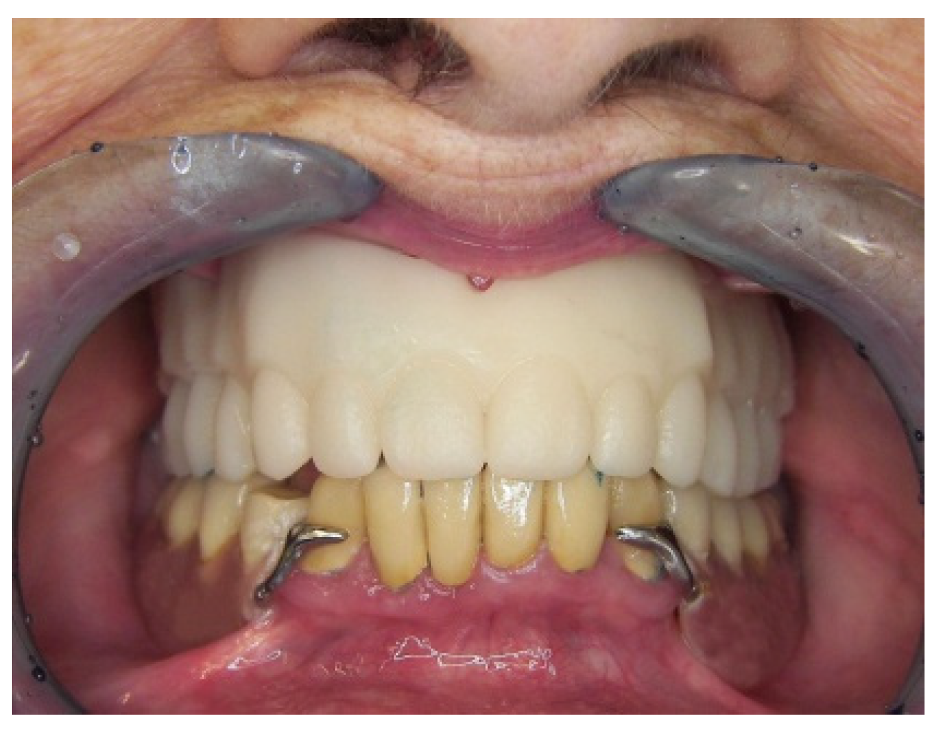 Prosthesis 03 00023 g016