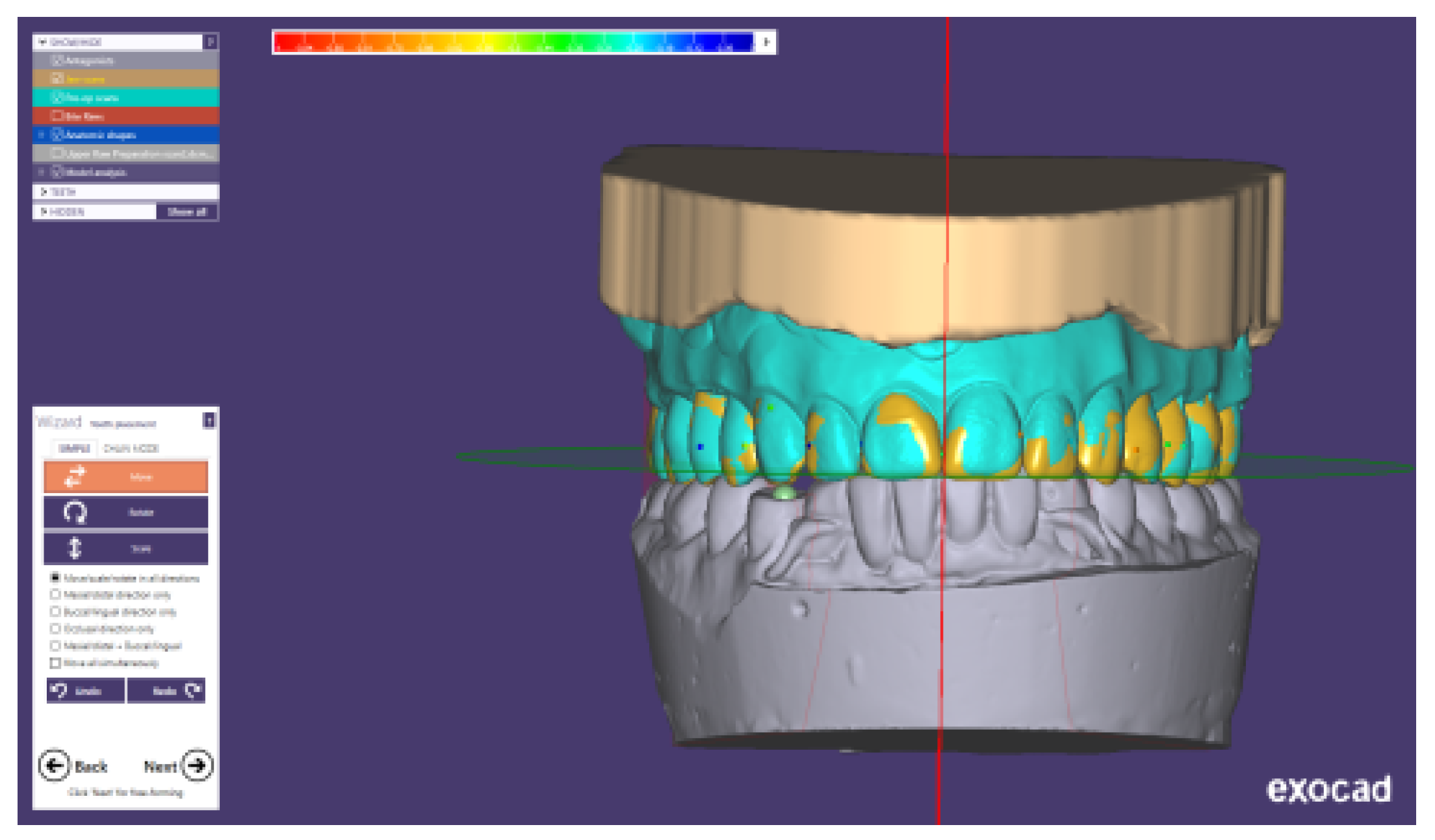 Prosthesis 03 00023 g017