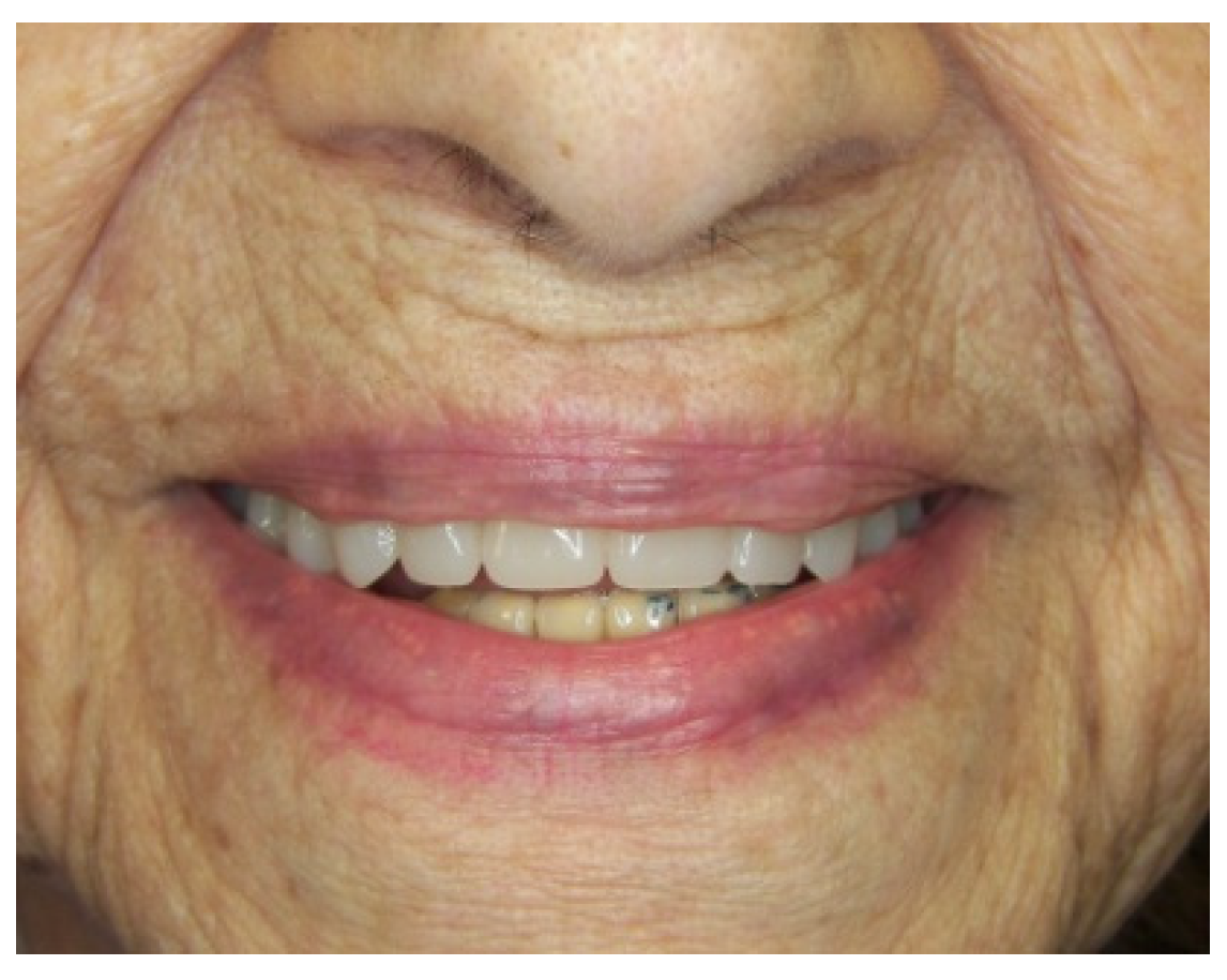 Prosthesis 03 00023 g023