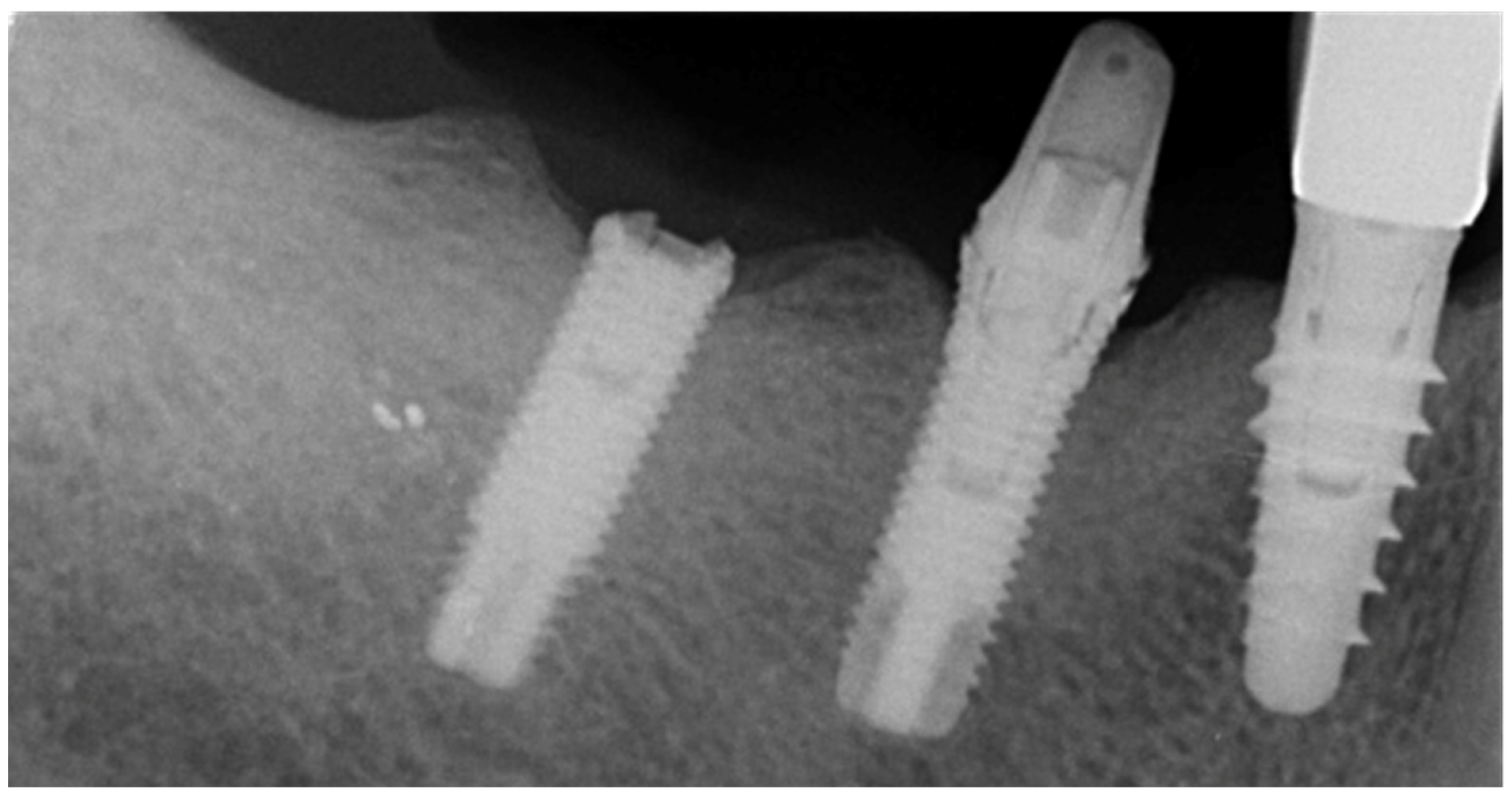 Prosthesis 03 00026 g001