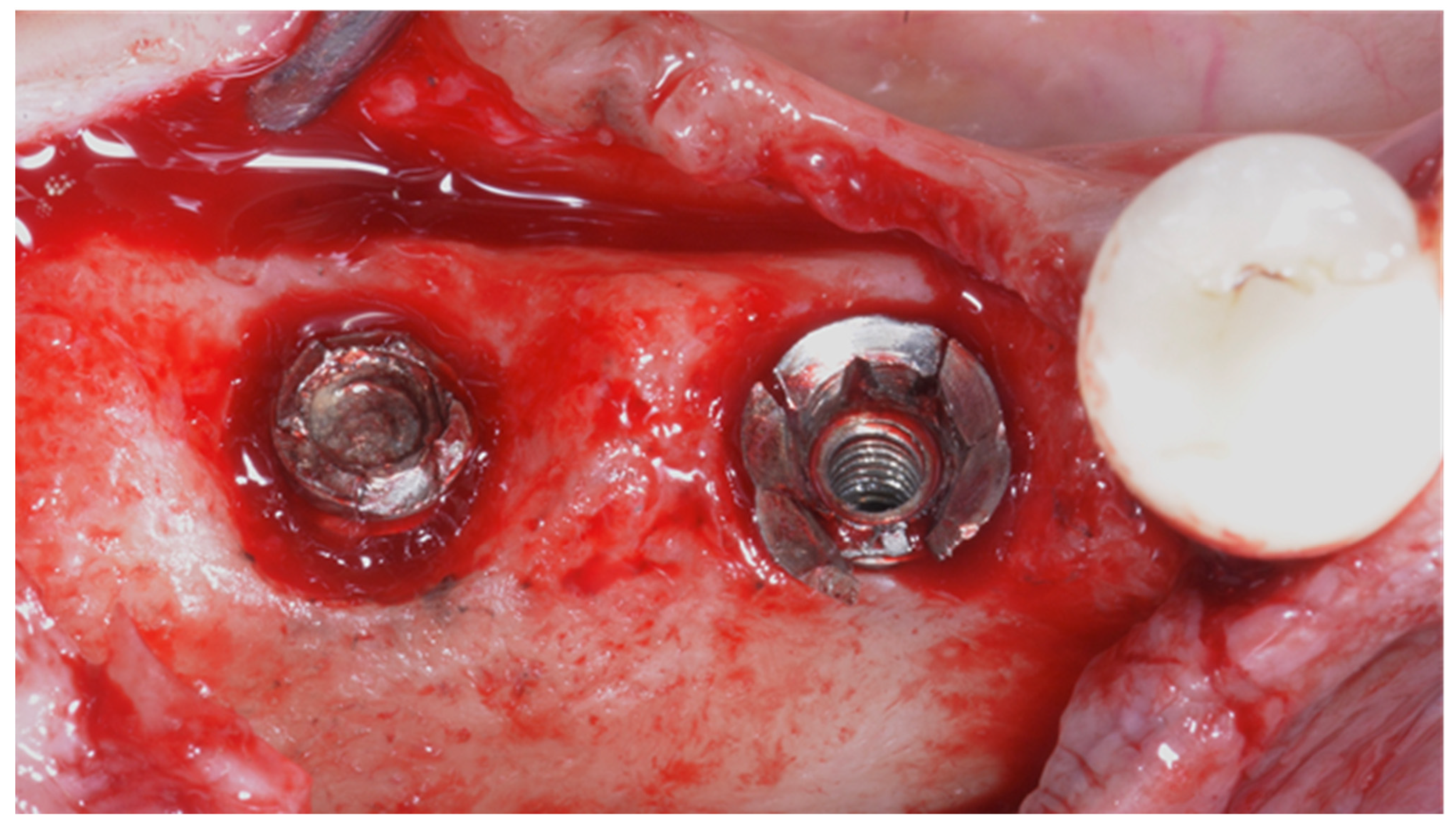 Prosthesis 03 00026 g003