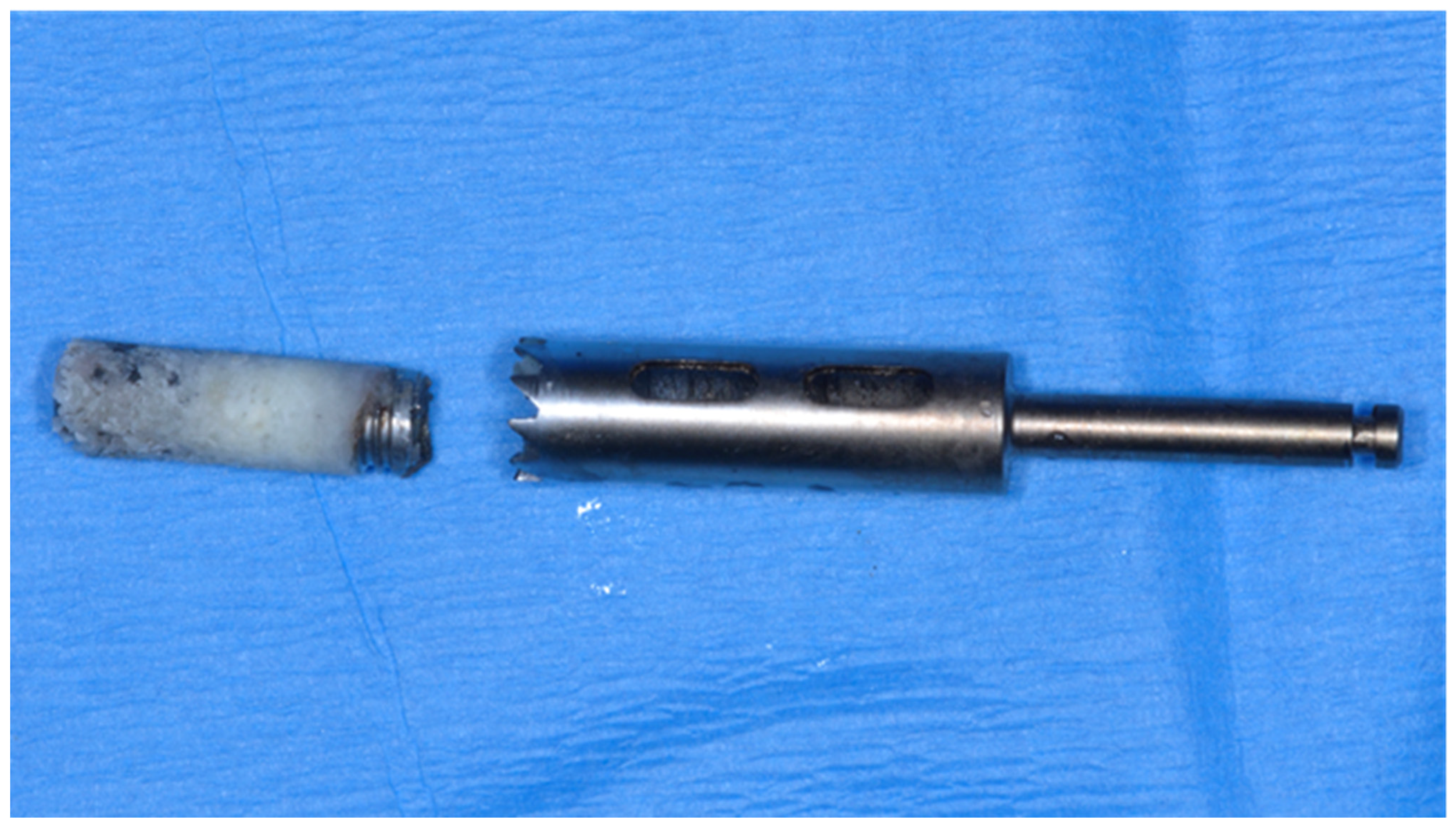 Prosthesis 03 00026 g004