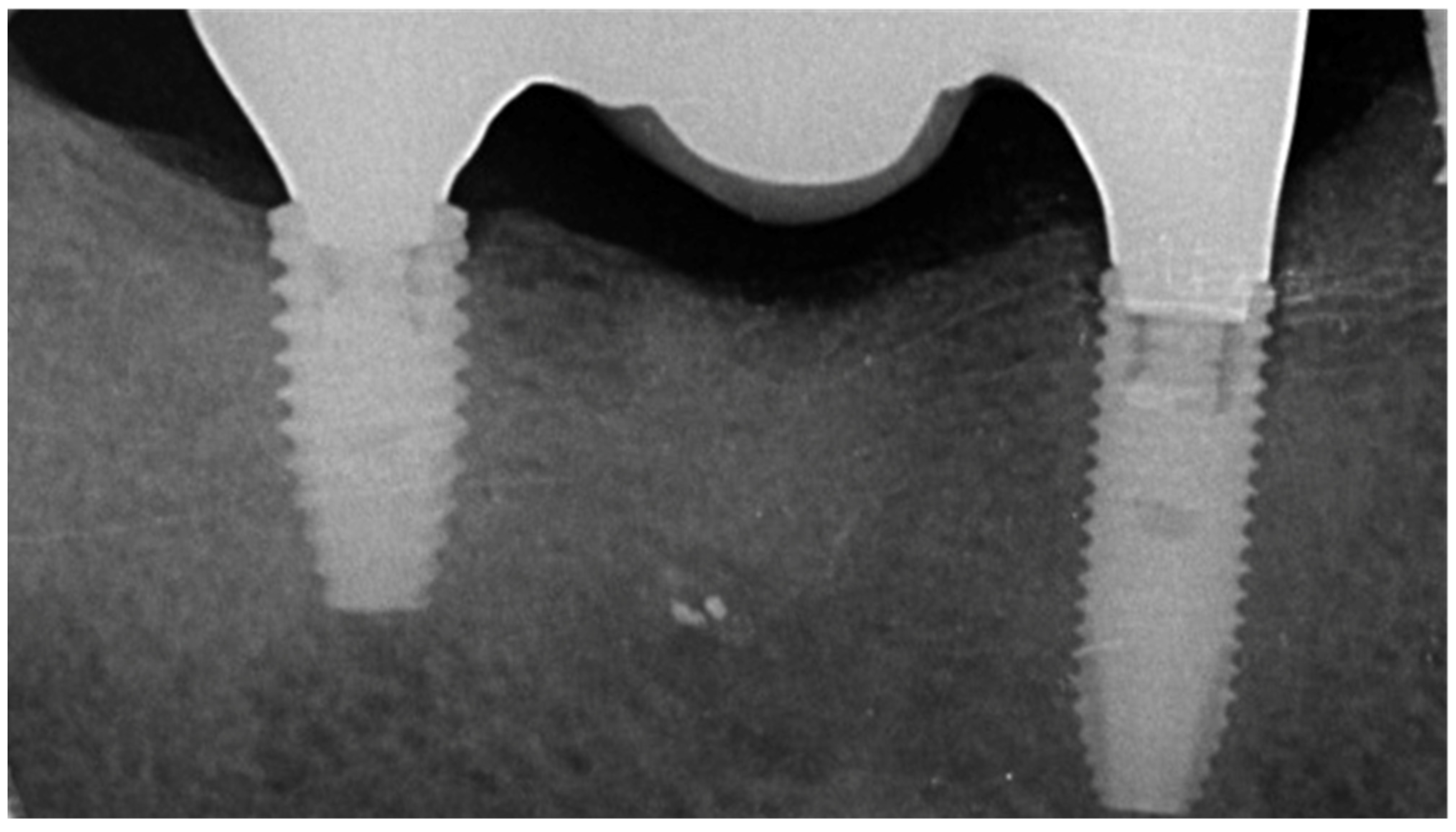 Prosthesis 03 00026 g005