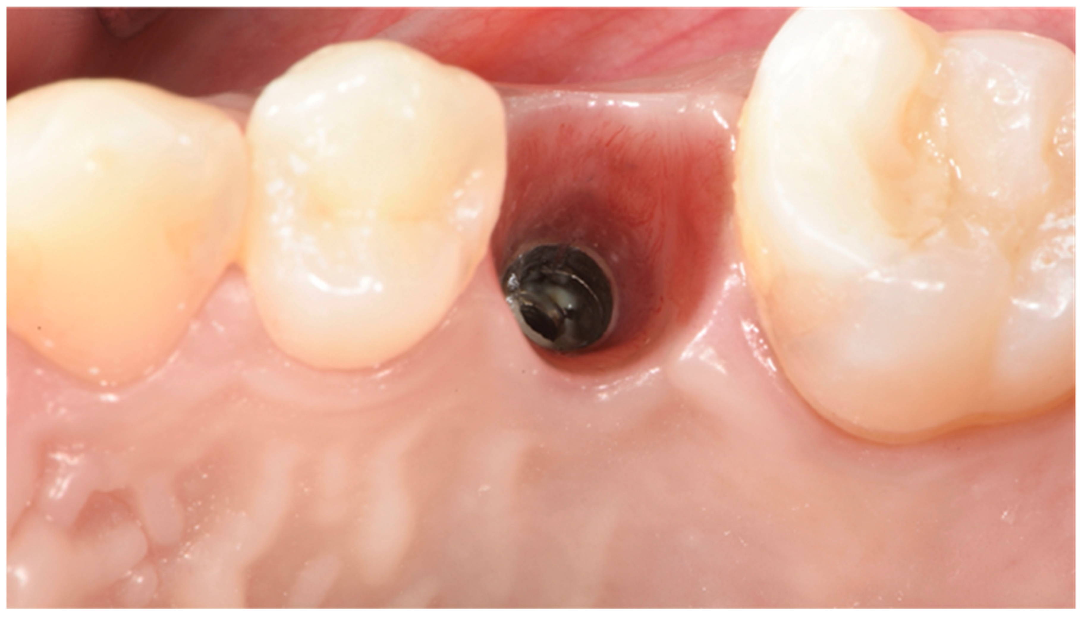 Prosthesis 03 00026 g007