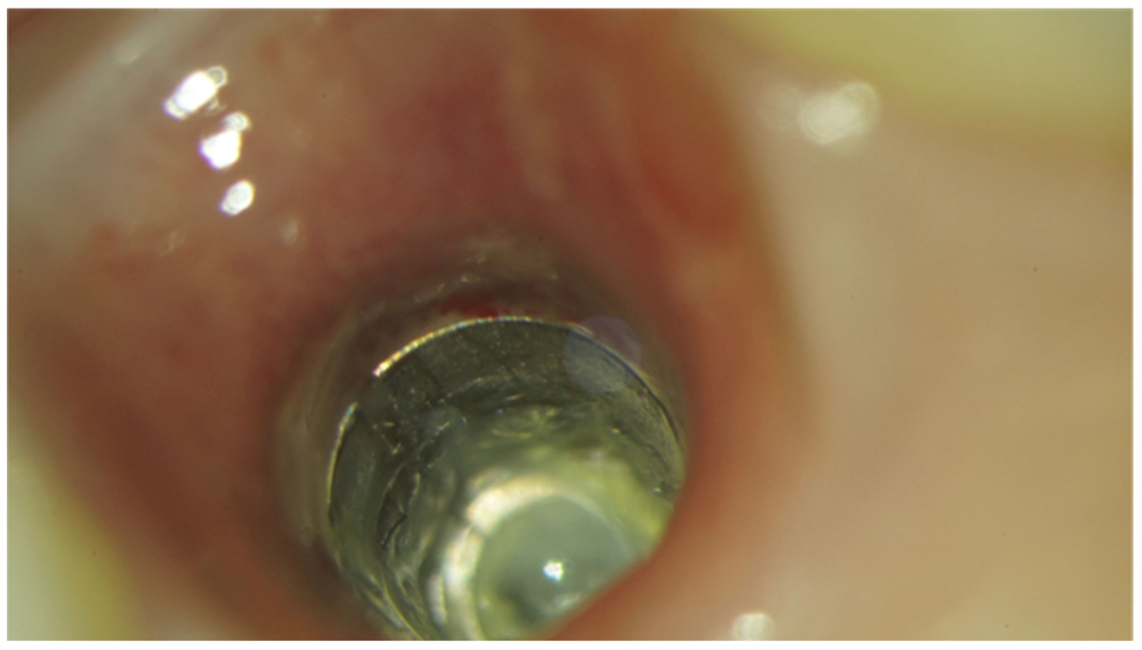 Prosthesis 03 00026 g008