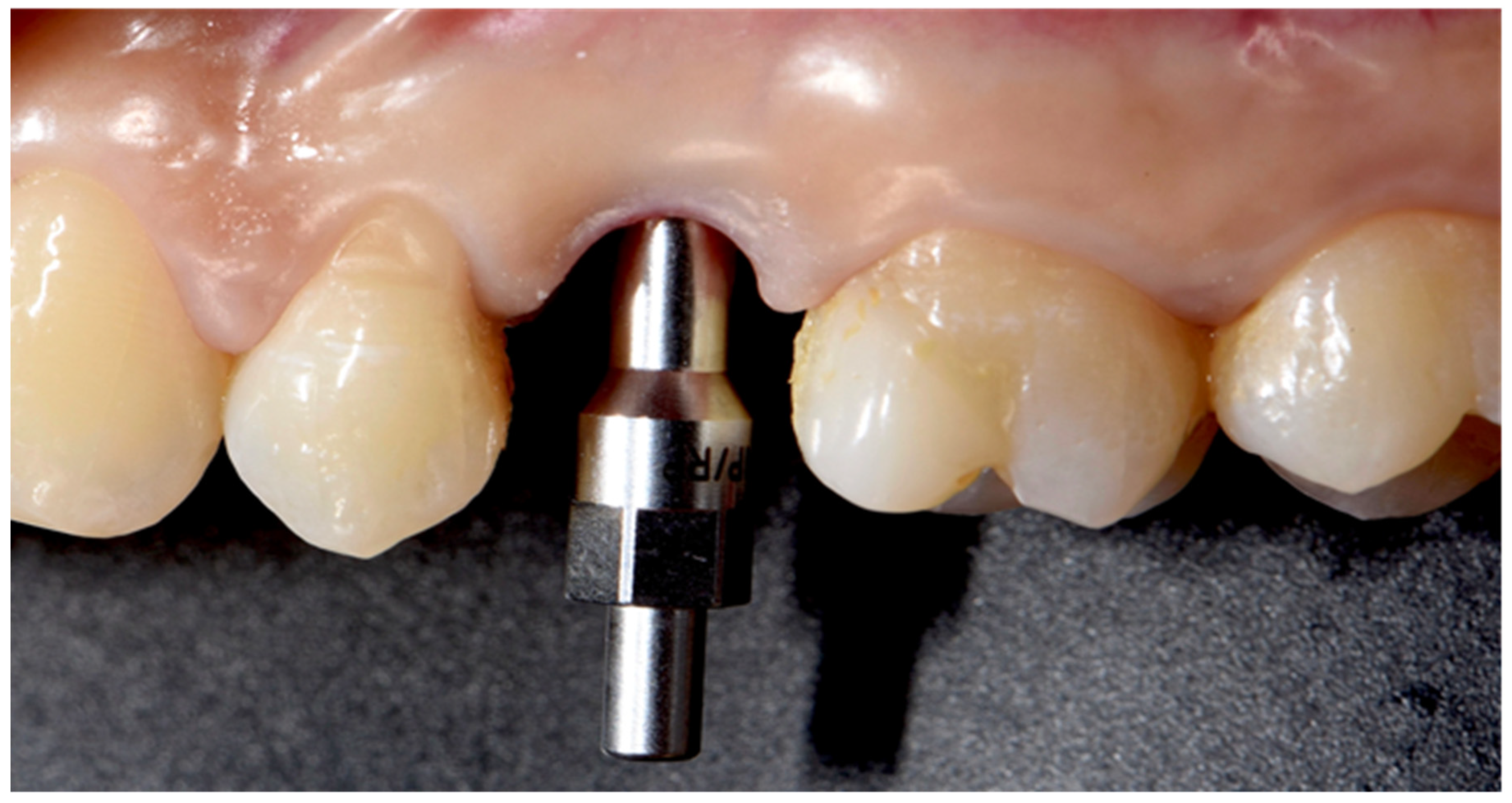 Prosthesis 03 00026 g009