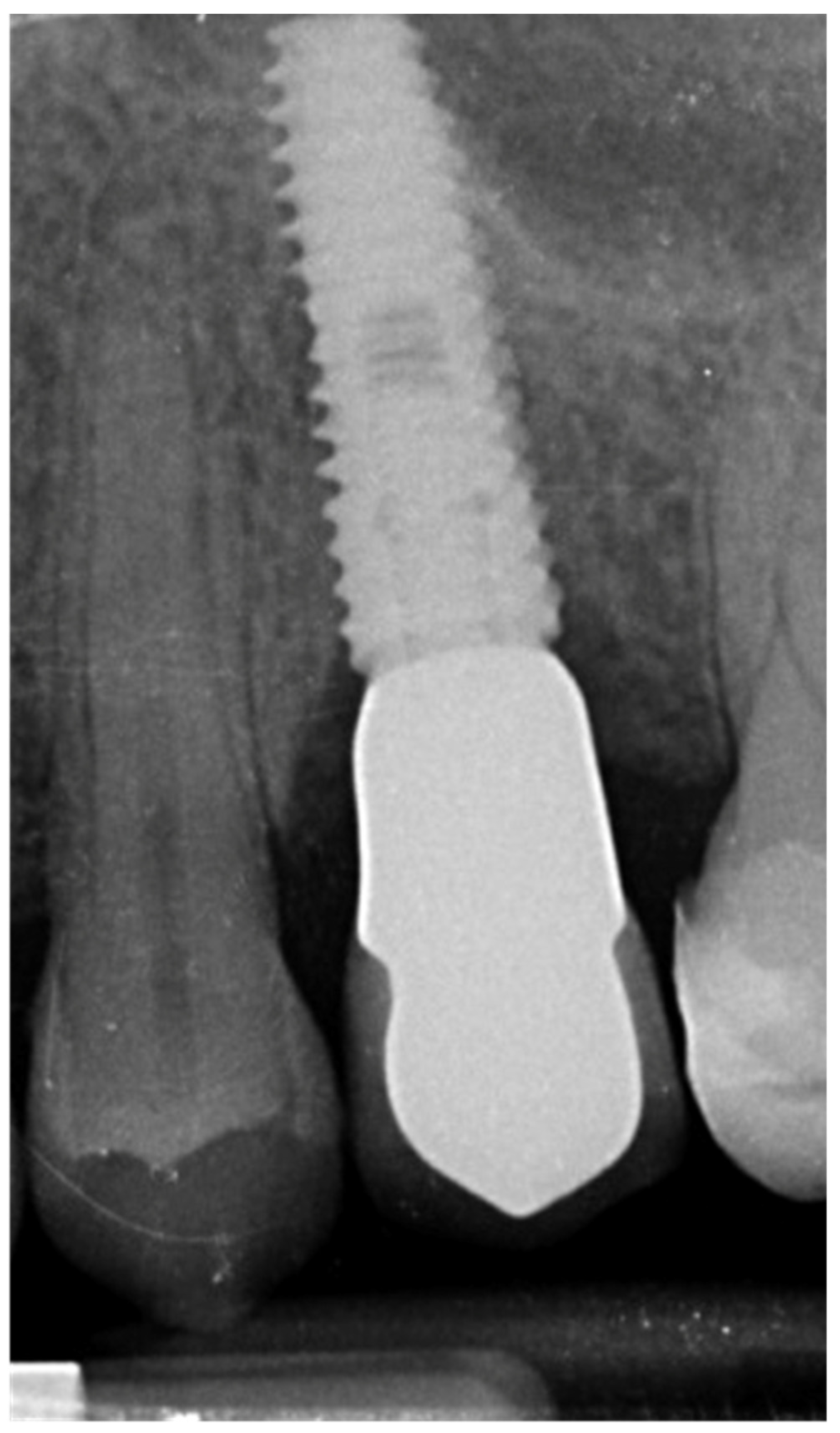 Prosthesis 03 00026 g010