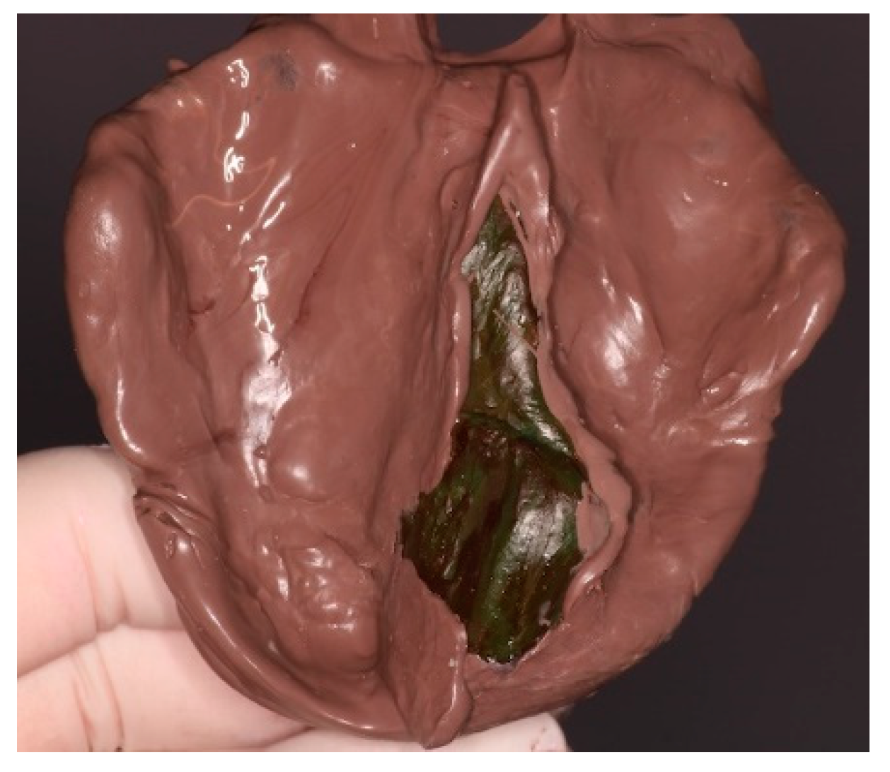 Prosthesis 03 00034 g005