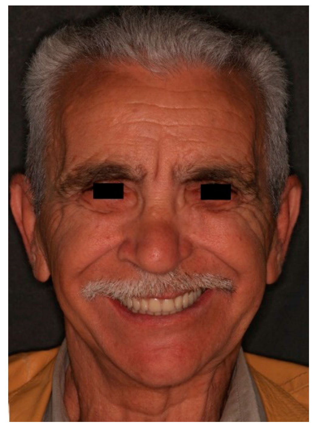 Prosthesis 03 00034 g007