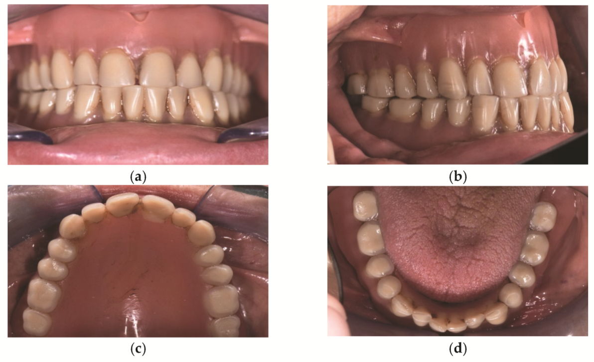 Prosthesis 03 00039 g001 Prosthesis 03 00039 g001
