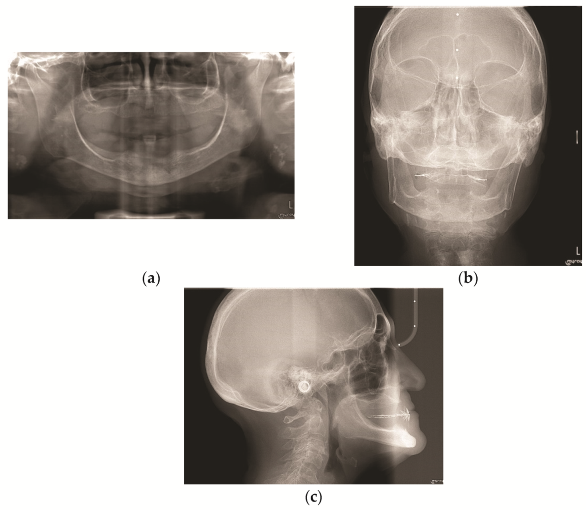 Prosthesis 03 00039 g002 Prosthesis 03 00039 g002