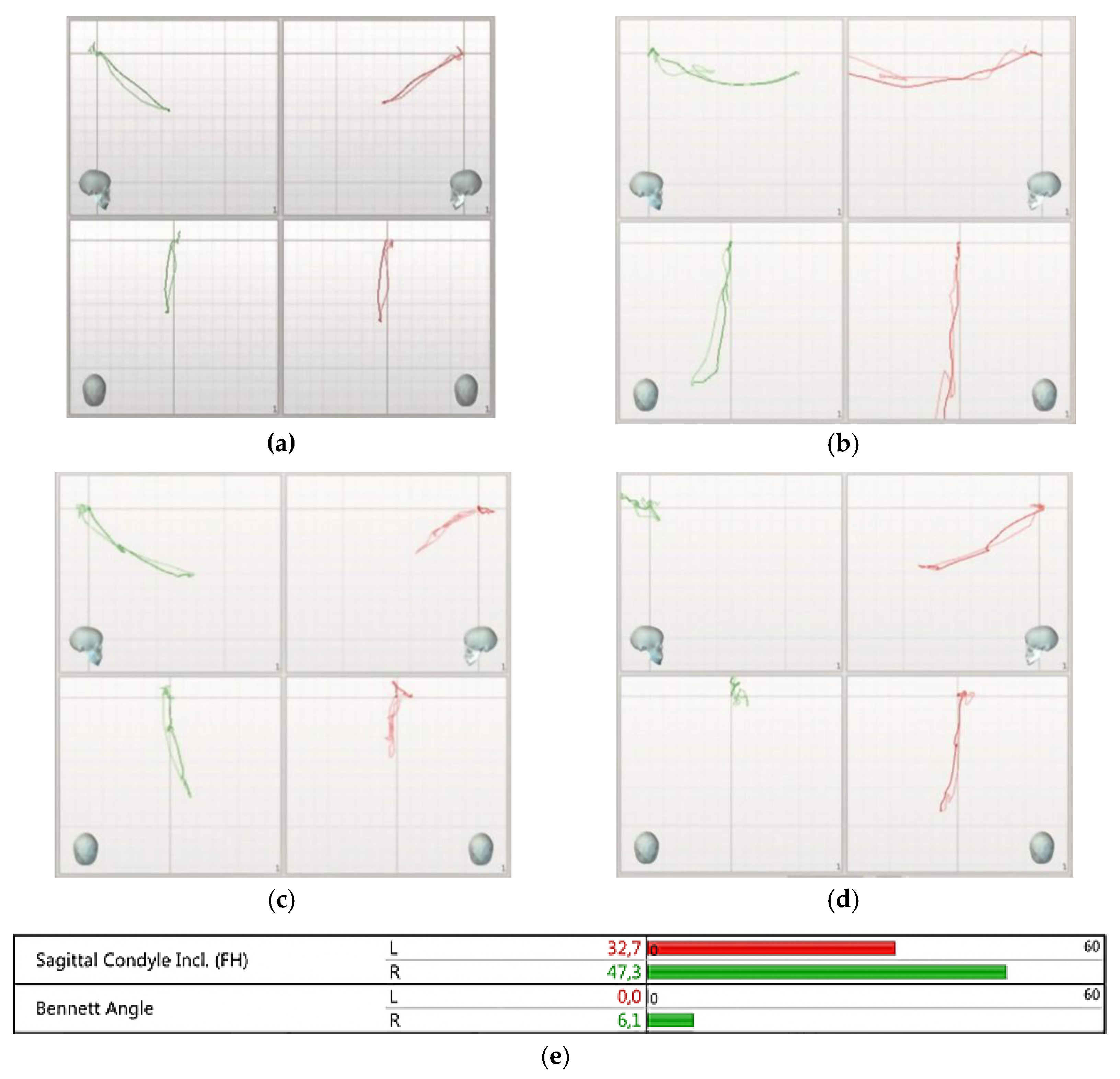 Prosthesis 03 00039 g003 Prosthesis 03 00039 g003