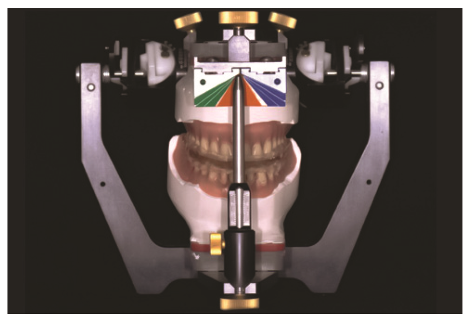 Prosthesis 03 00039 g005 Prosthesis 03 00039 g005