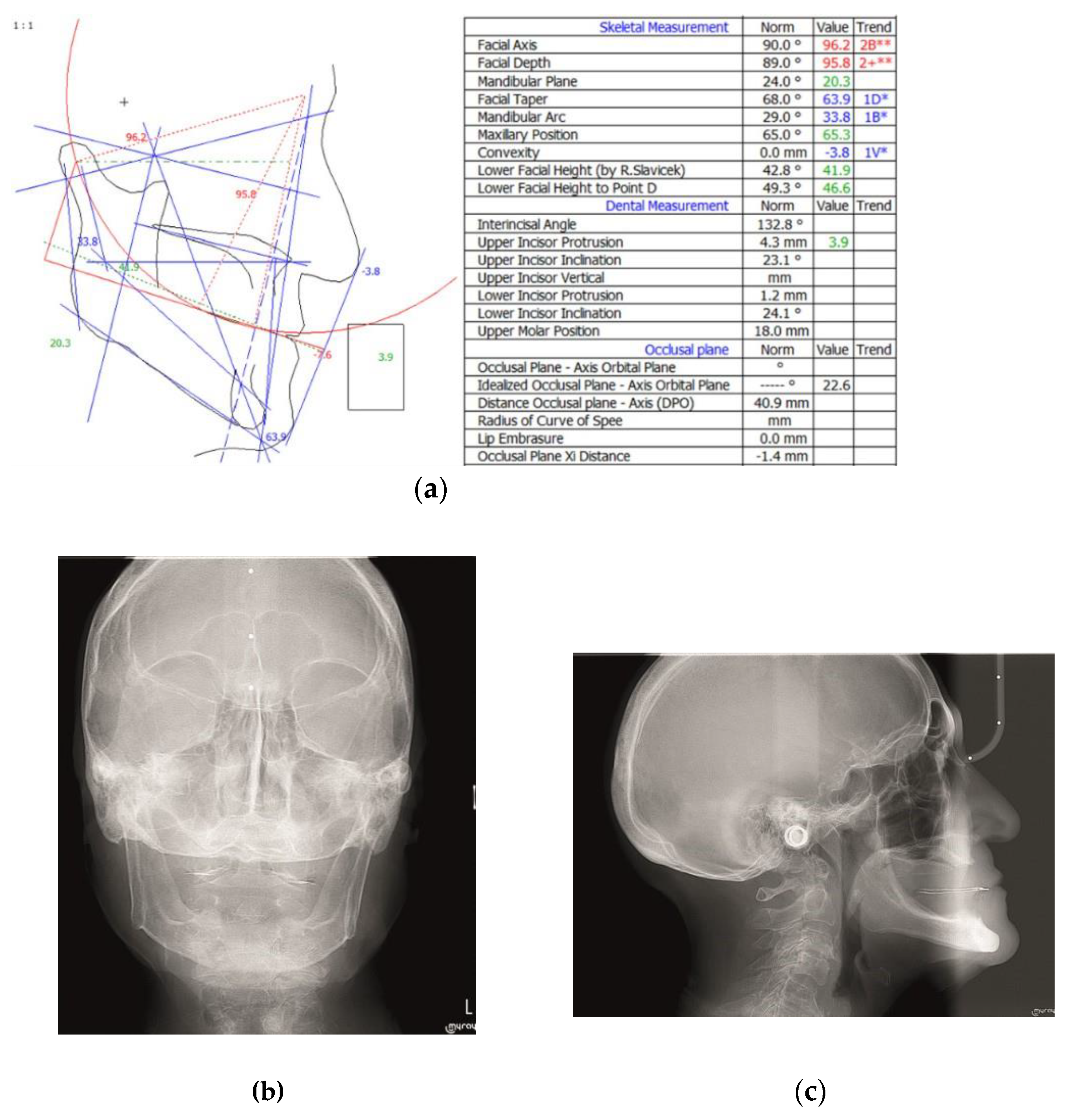 Prosthesis 03 00039 g006 Prosthesis 03 00039 g006