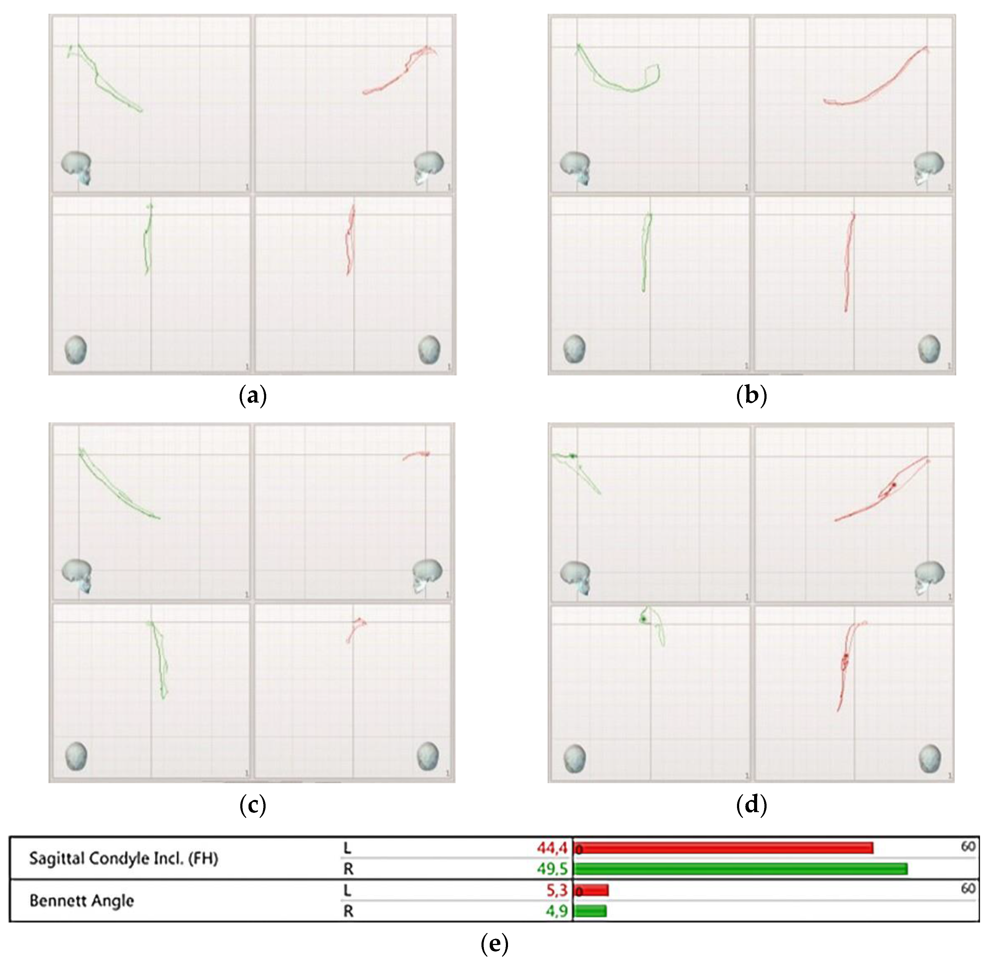 Prosthesis 03 00039 g007 Prosthesis 03 00039 g007