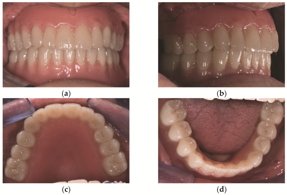 Prosthesis 03 00039 g008 Prosthesis 03 00039 g008