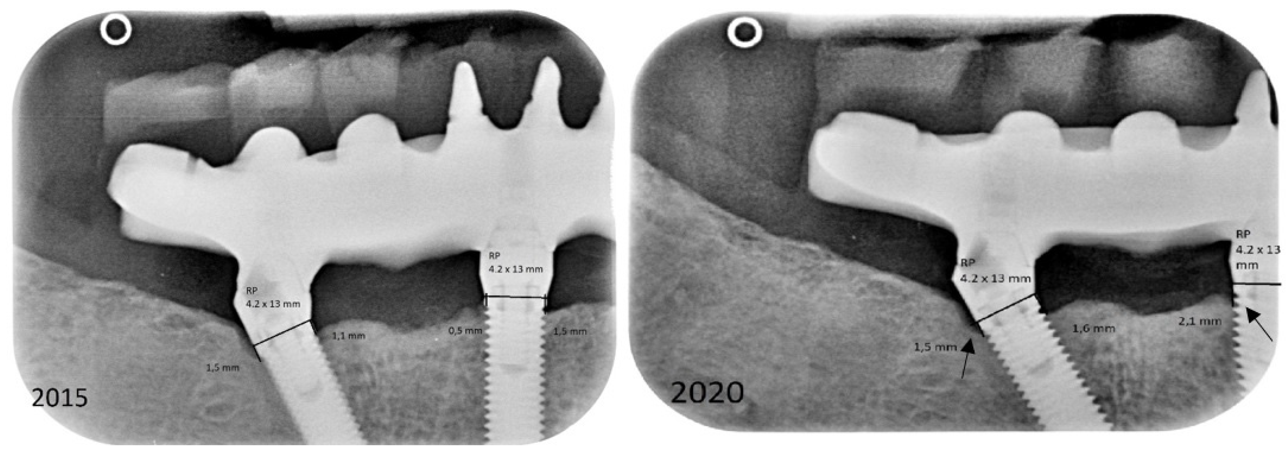Prosthesis 04 00002 g003