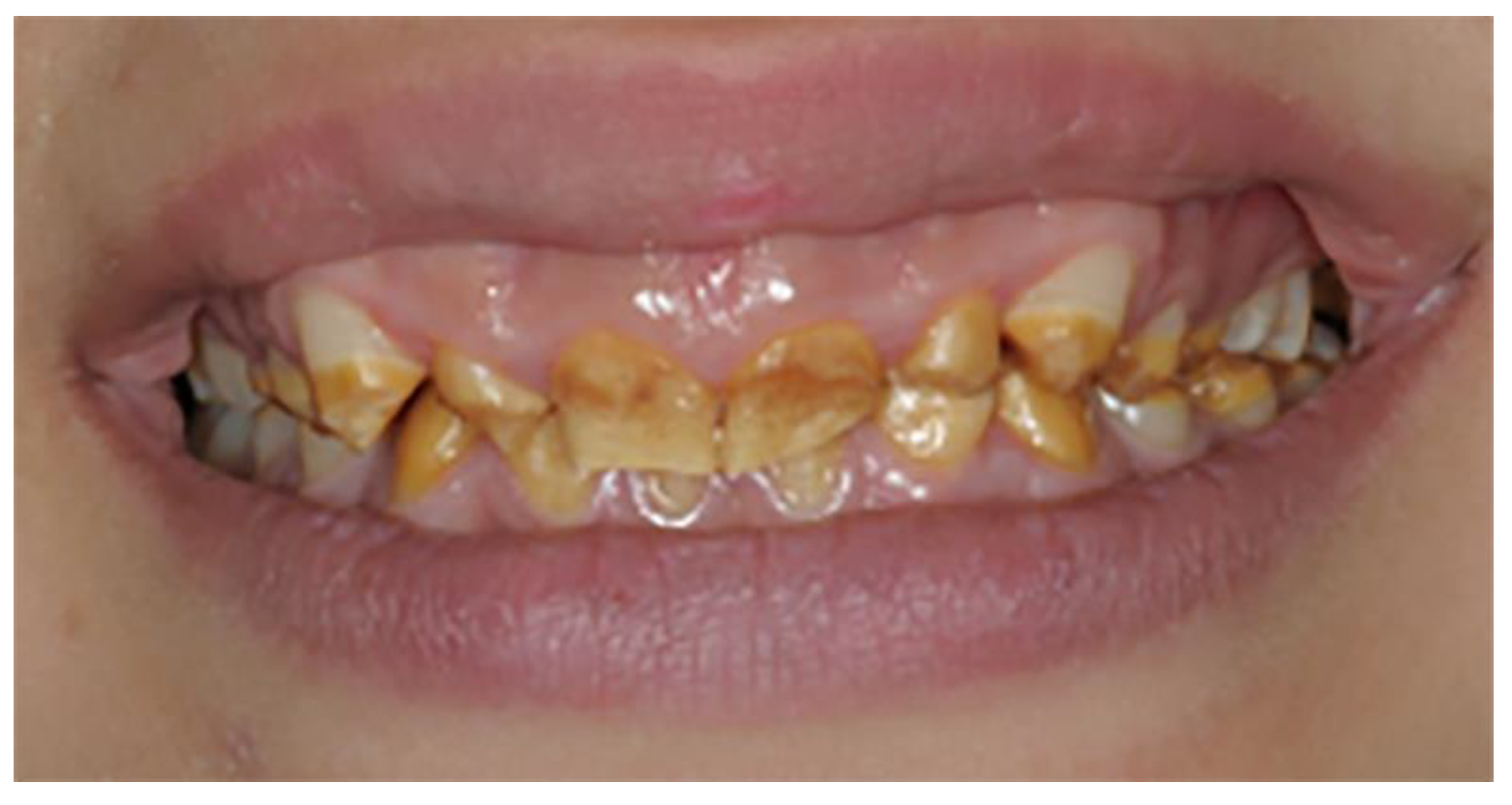 Prosthesis 04 00014 g010