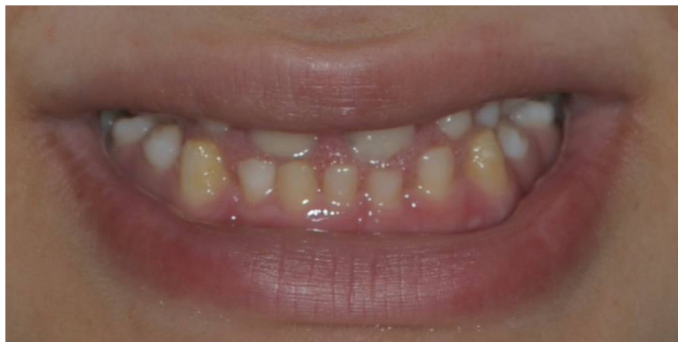 Prosthesis 04 00014 g012
