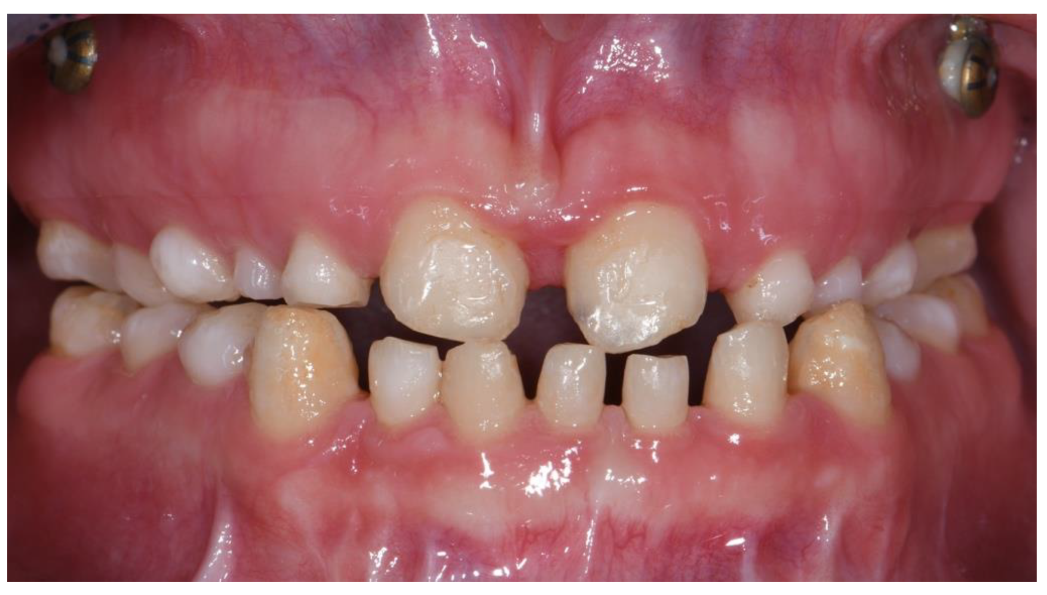 Prosthesis 04 00014 g013