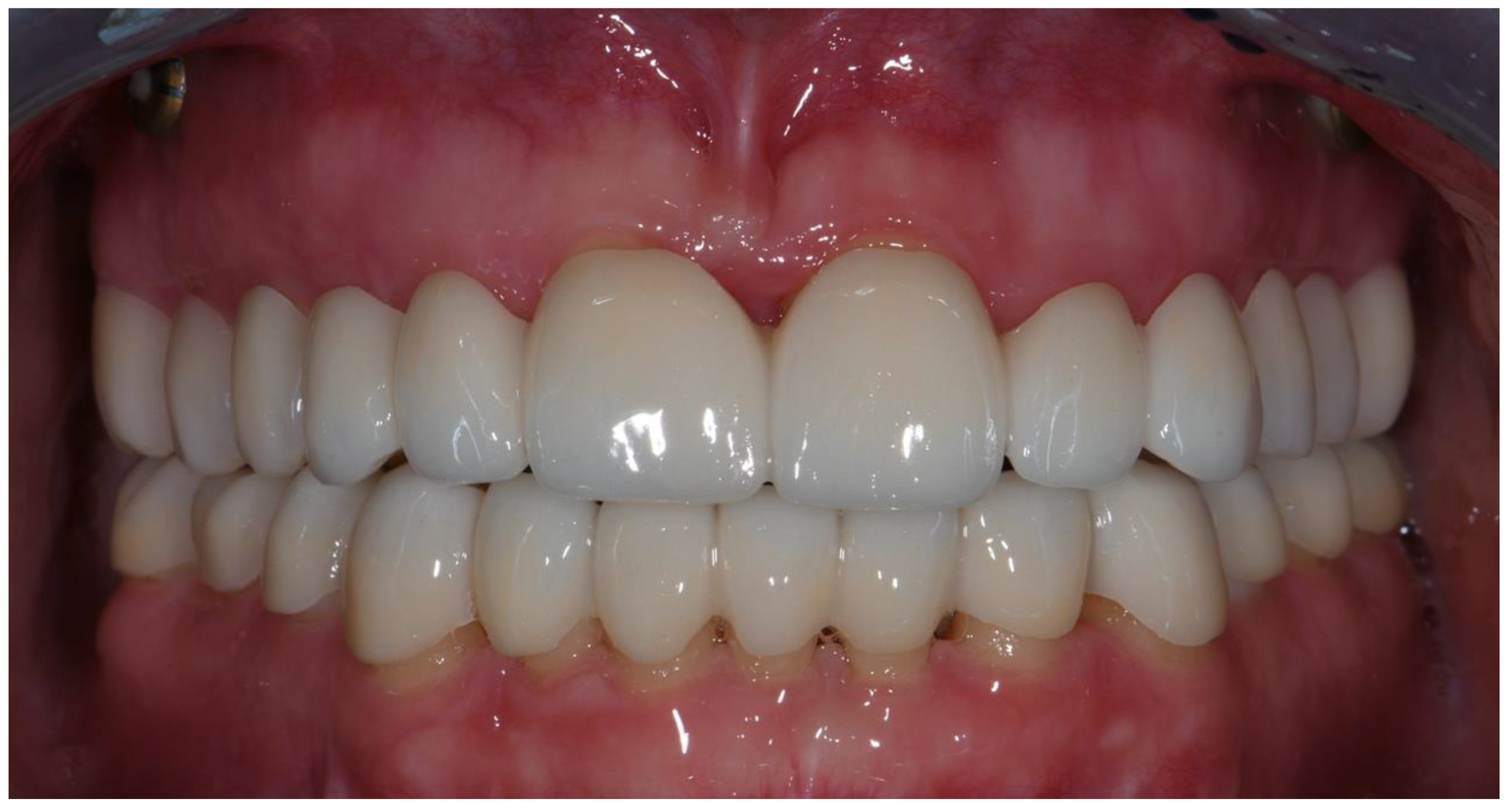 Prosthesis 04 00014 g015