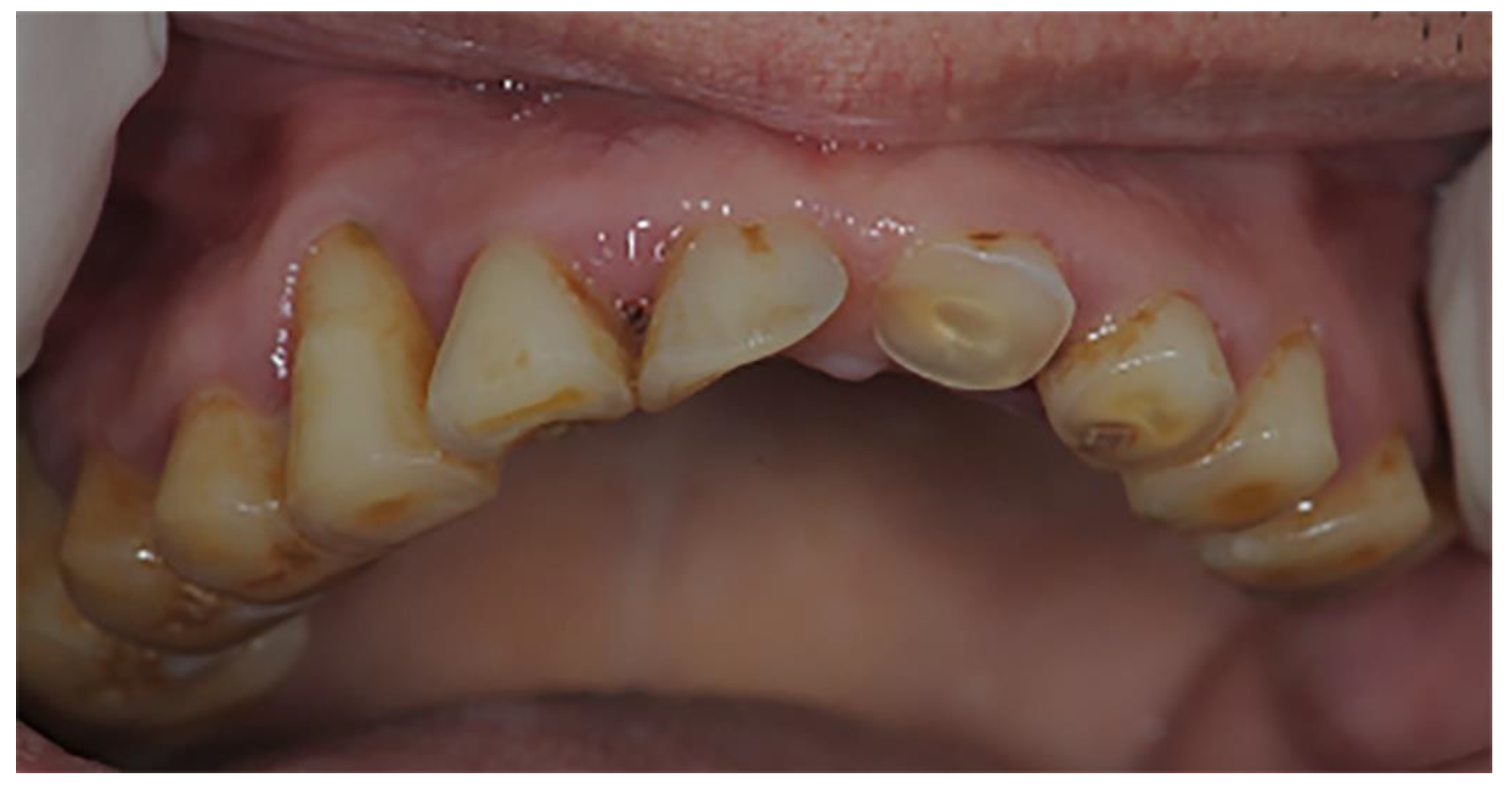 Prosthesis 04 00014 g017