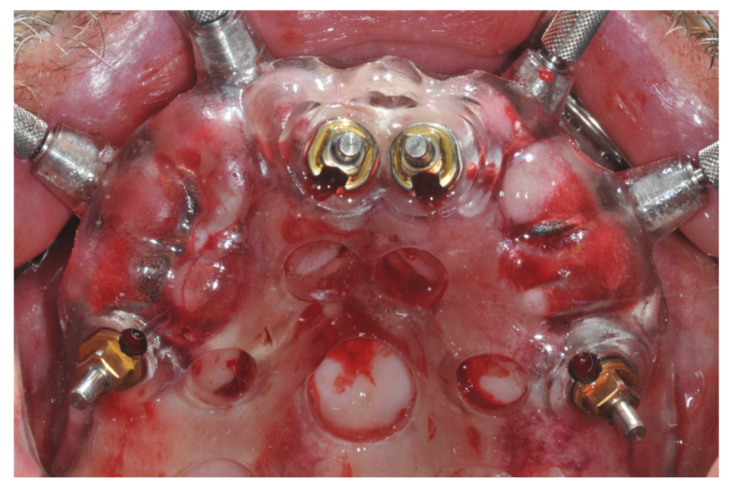 Prosthesis 04 00020 g004 Prosthesis 04 00020 g004